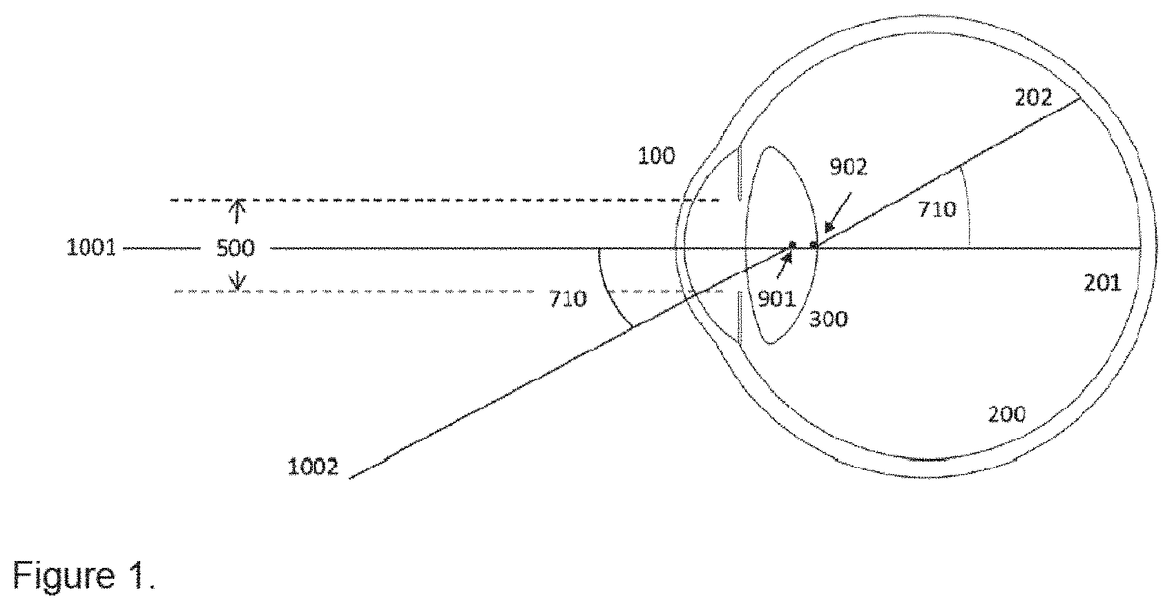 Patent US11771551 — Method to design and manufacture an intraocular lens — Figure 1