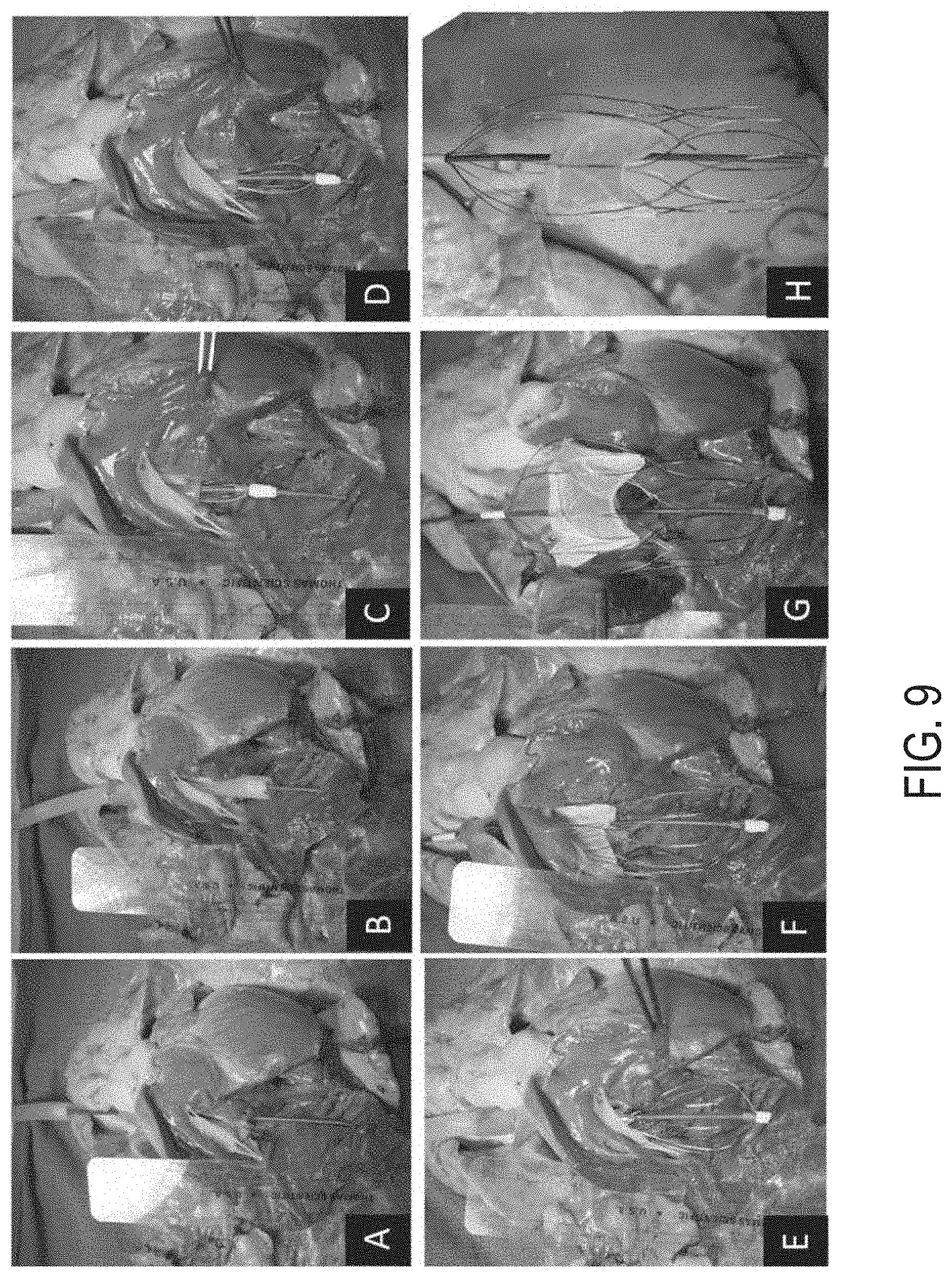 Patent US11771555 Figure 13 – Retrievable self-expanding non-thrombogenic low-profile percutaneous atrioventricular valve prosthesis