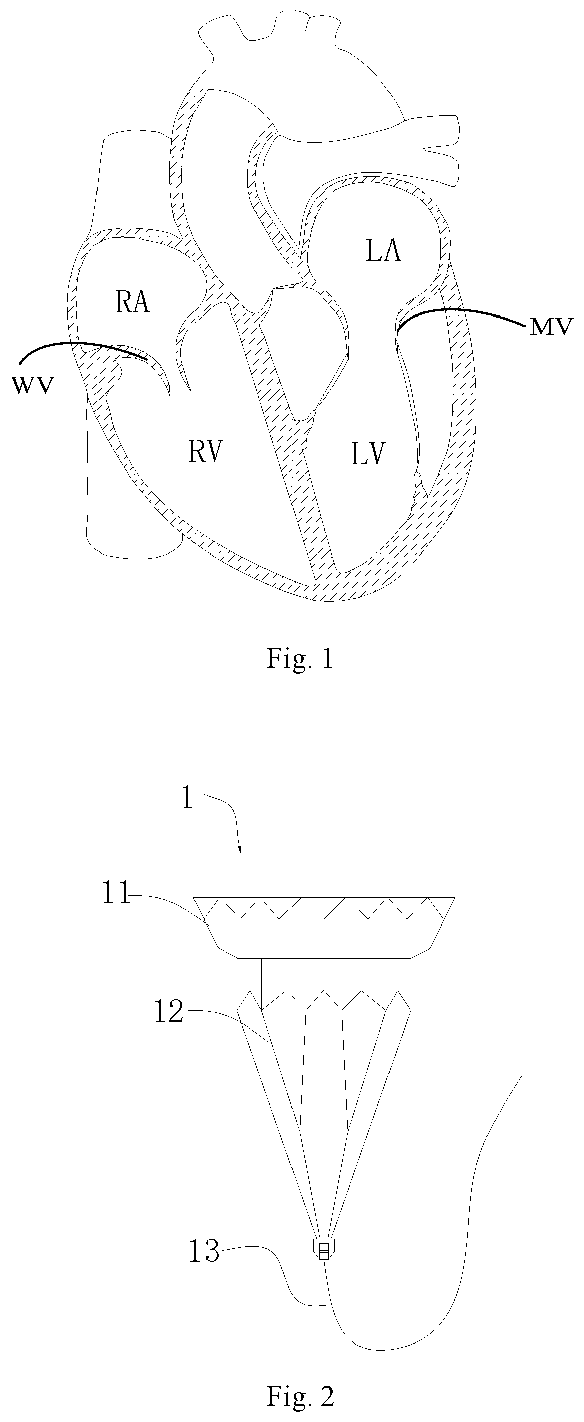 Patent US11771556 Figure 1 – Intervention guidance device