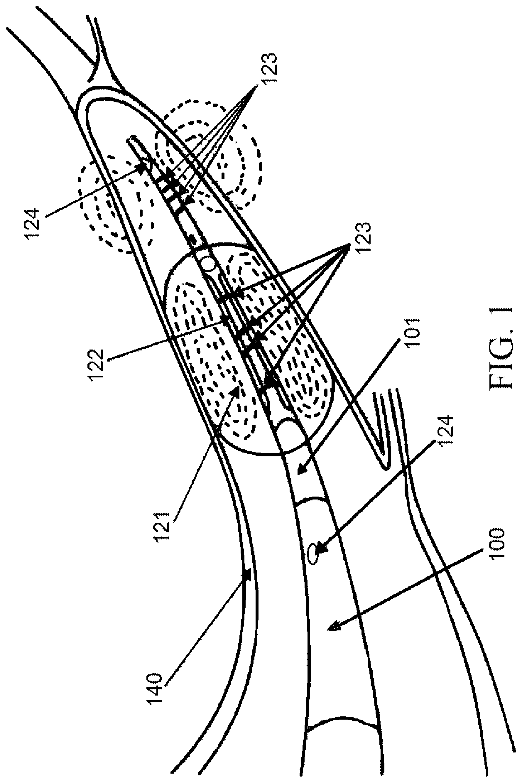 Patent US11771558 — Devices and methods for controlling blood perfusion pressure along with regional mild hypothermia — Figure 1