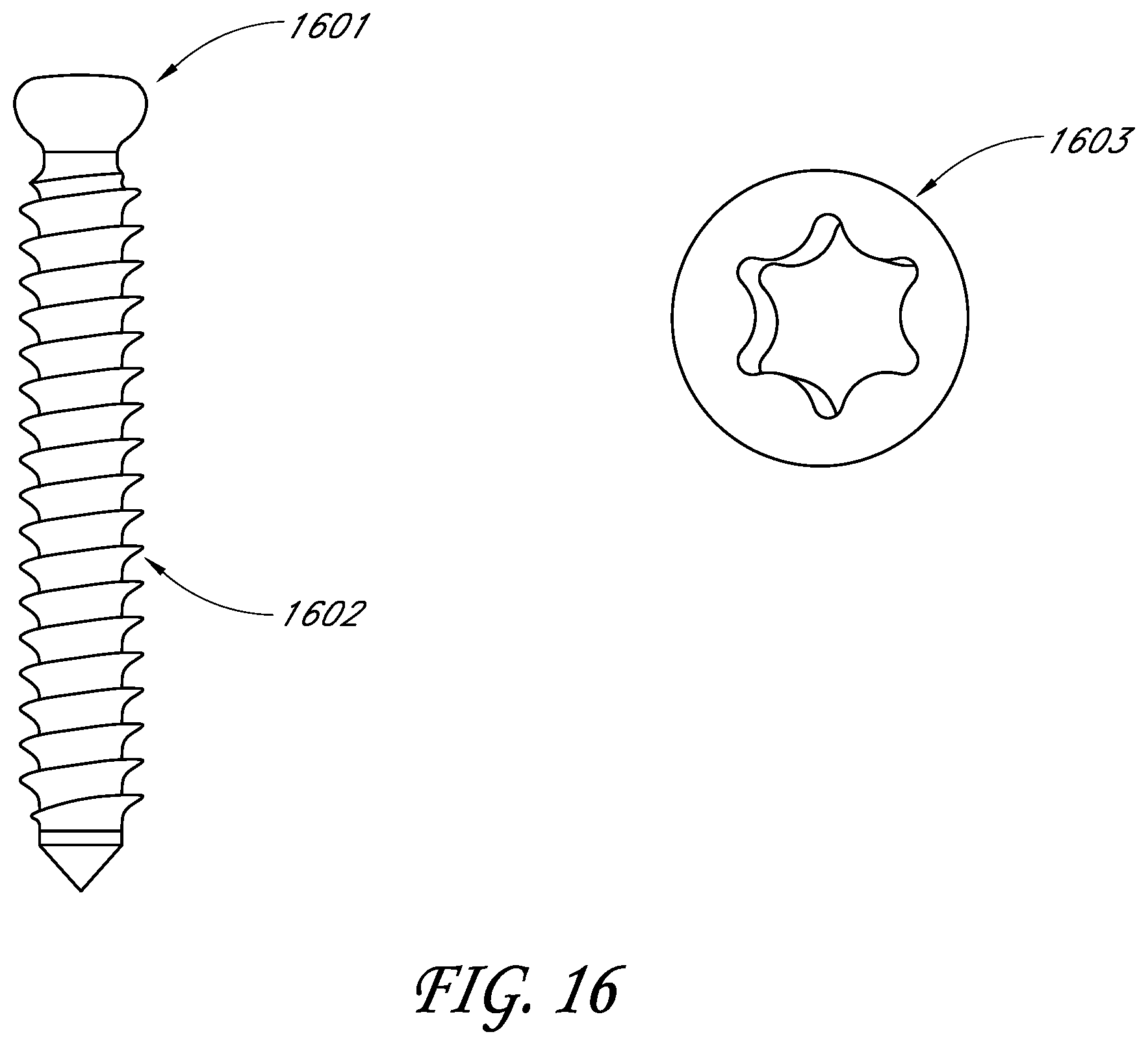 Patent US11771561 Figure 18 – Total reverse shoulder systems and methods