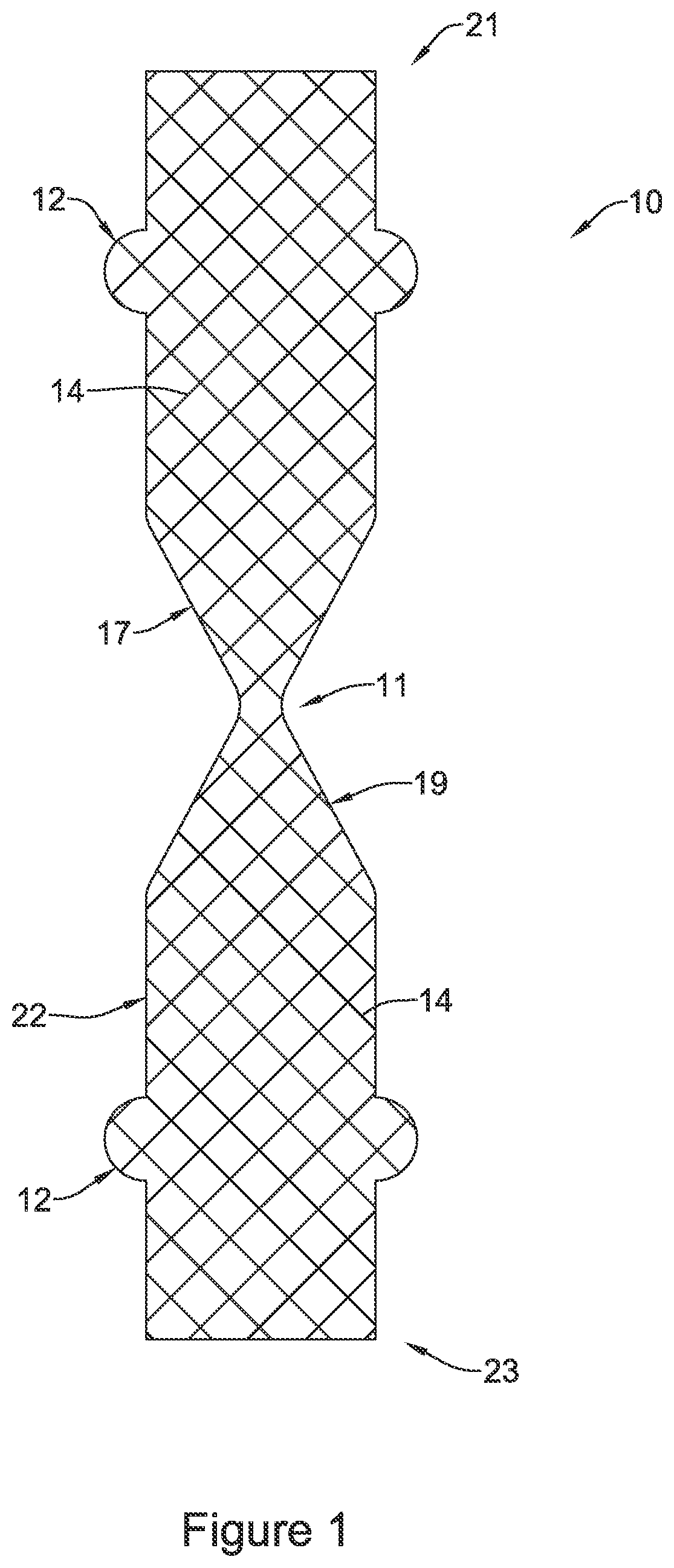 Patent US11771574 — Esophageal stent including a valve member — Figure 1