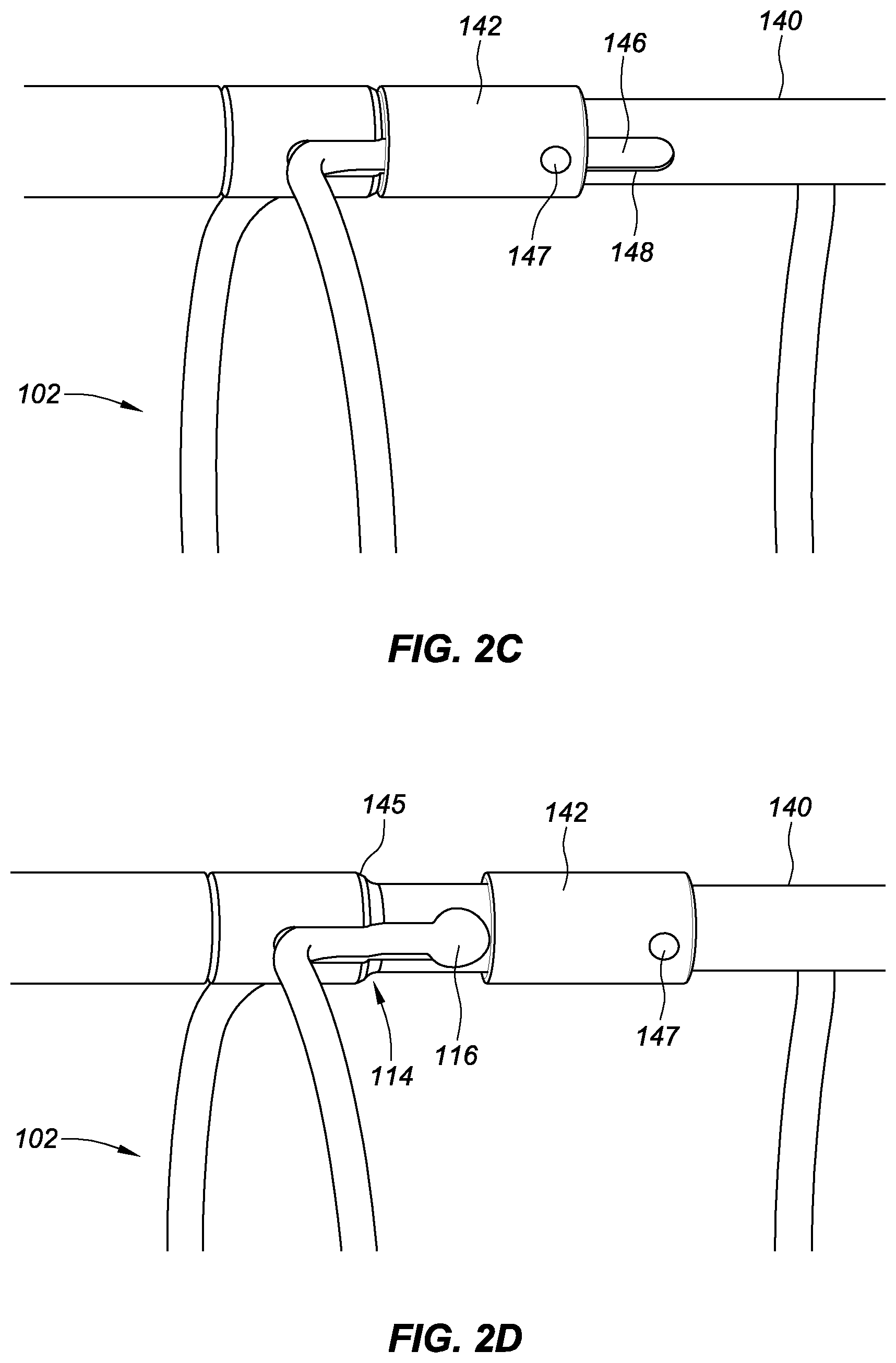Patent US11771575 Figure 4 – Systems, devices, and methods for the accurate deployment and imaging of an implant in the prostatic urethra
