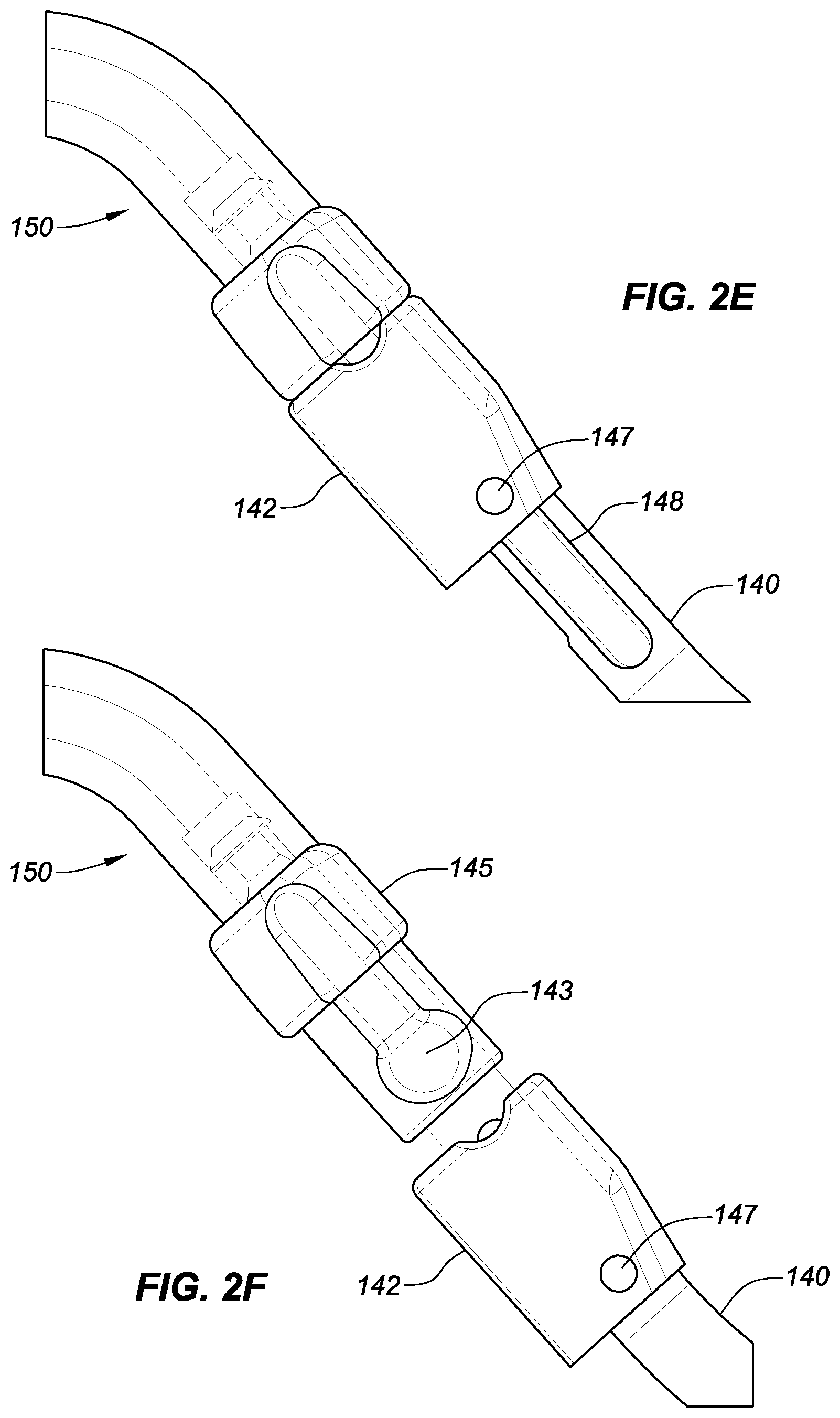 Patent US11771575 Figure 5 – Systems, devices, and methods for the accurate deployment and imaging of an implant in the prostatic urethra