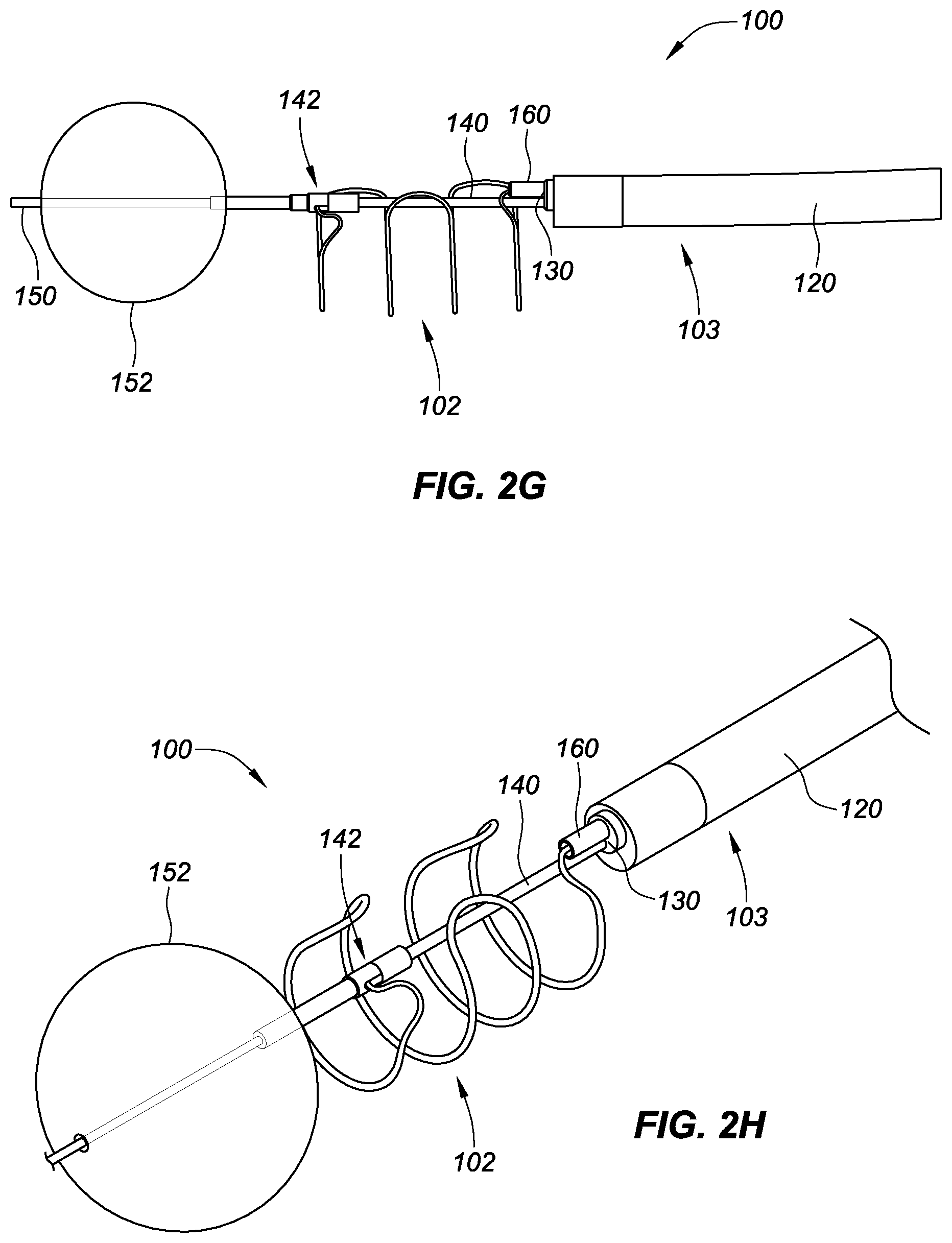 Patent US11771575 Figure 6 – Systems, devices, and methods for the accurate deployment and imaging of an implant in the prostatic urethra