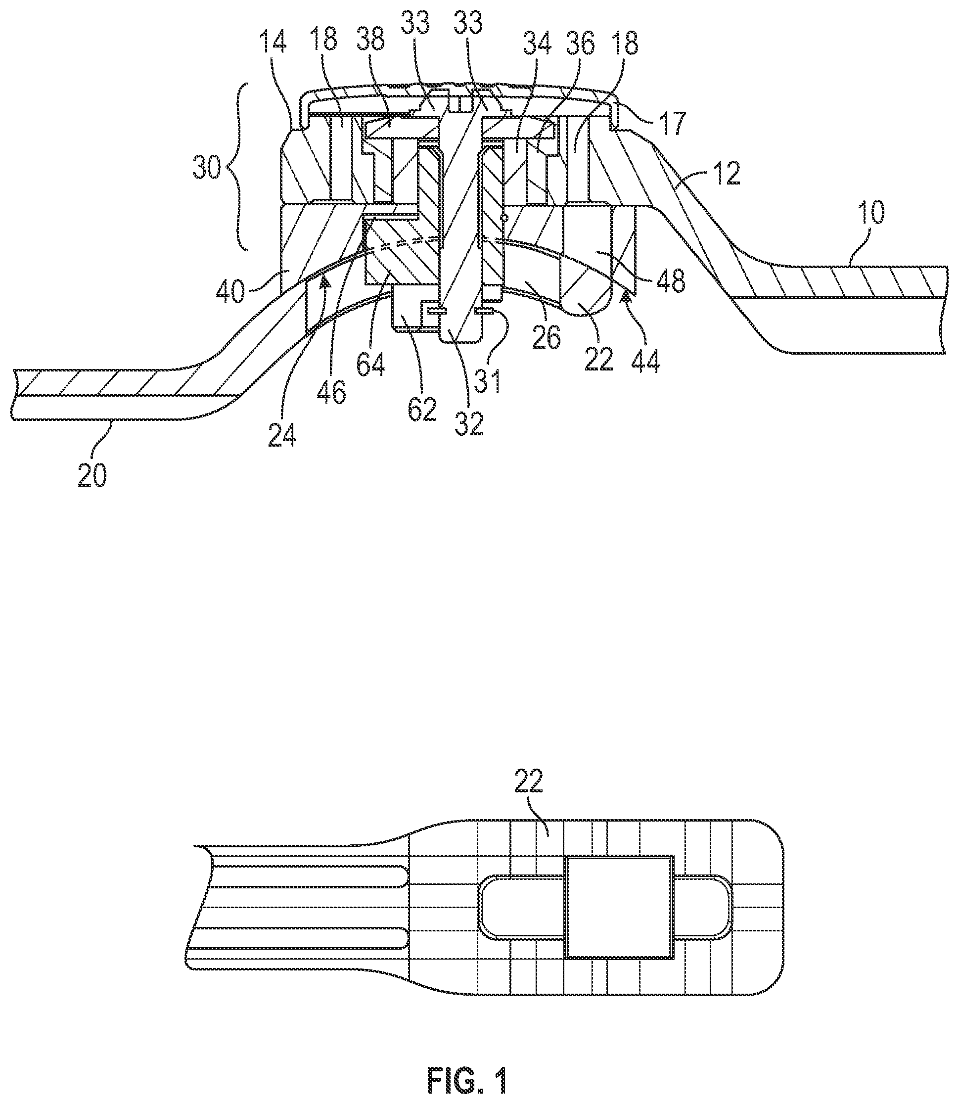 Patent US11771576 — Tiltable articulated joint brace — Figure 1