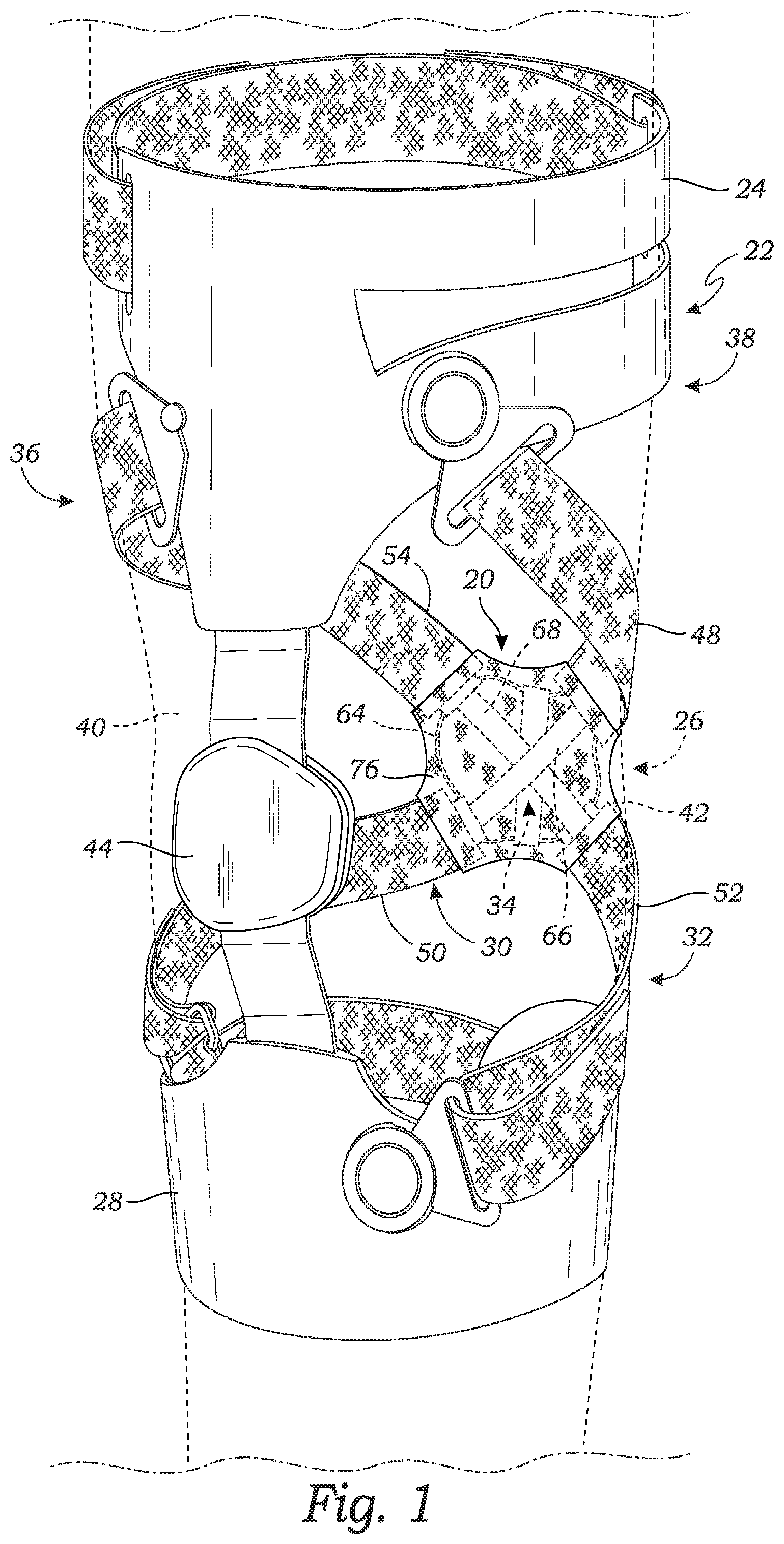 Patent US11771578 — Cross-strap tensioning apparatus for osteoarthritis braces — Figure 1