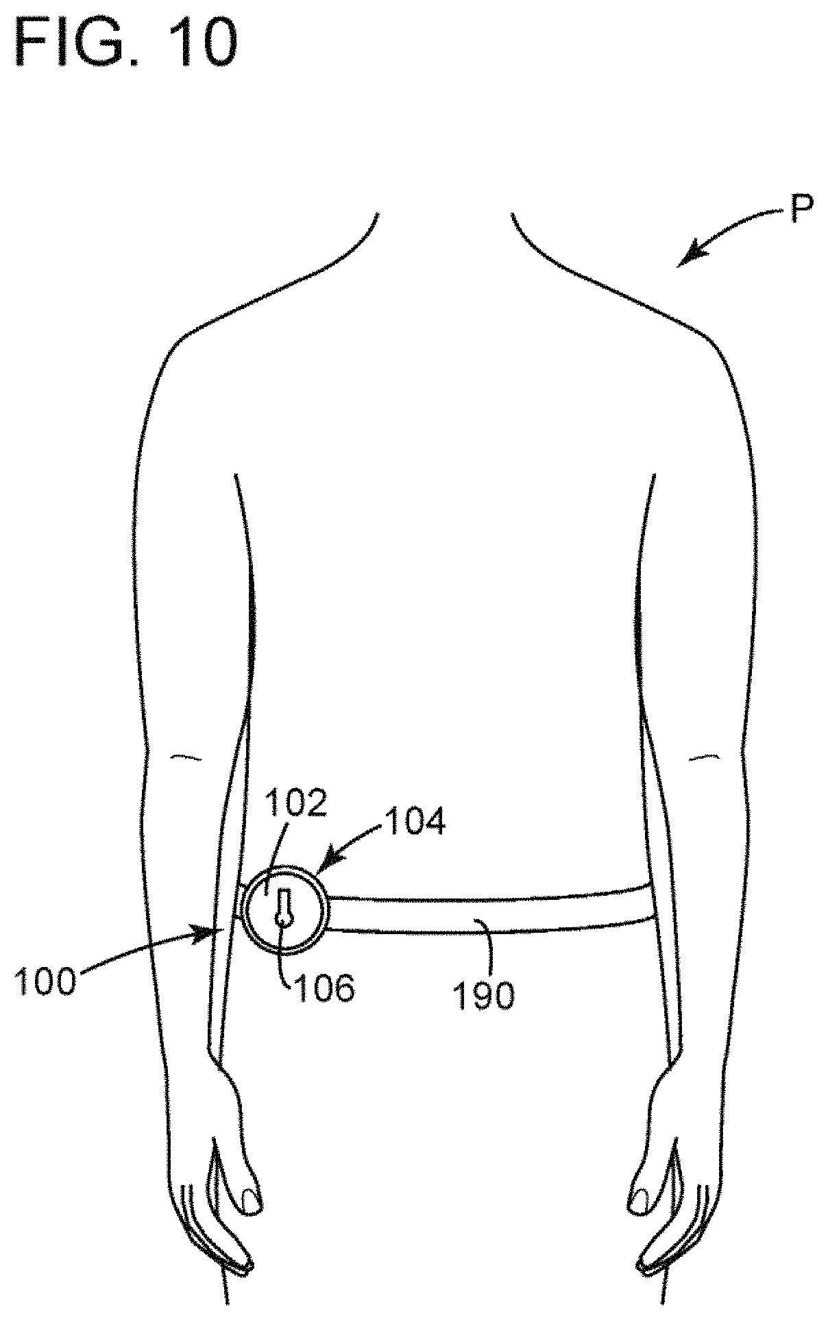 Patent US11771585 Figure 8 – Devices, systems and methods for regulating flow from a stoma on a patient