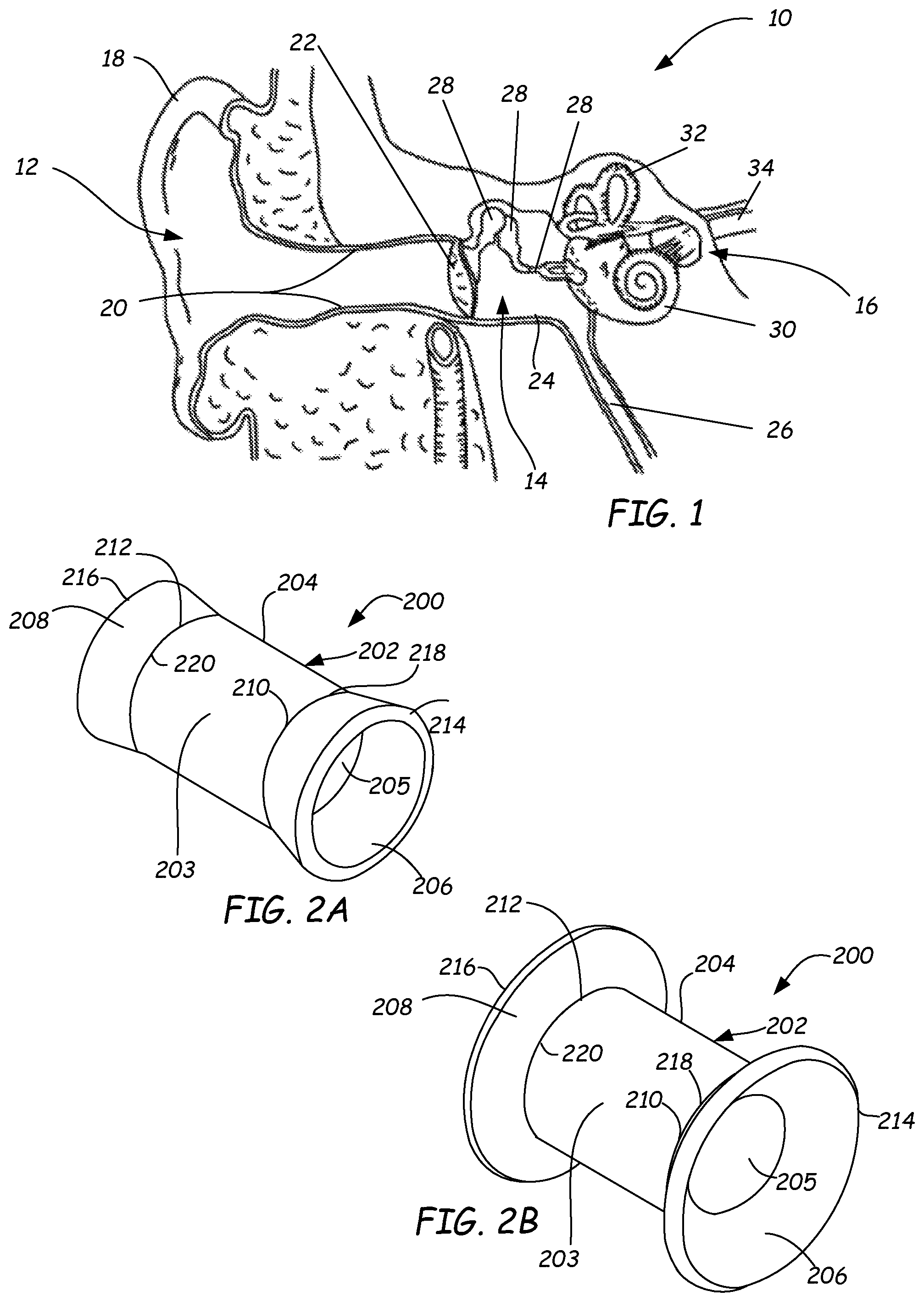 Patent US11771598 — Ventilation device and insertion system therefor — Figure 1