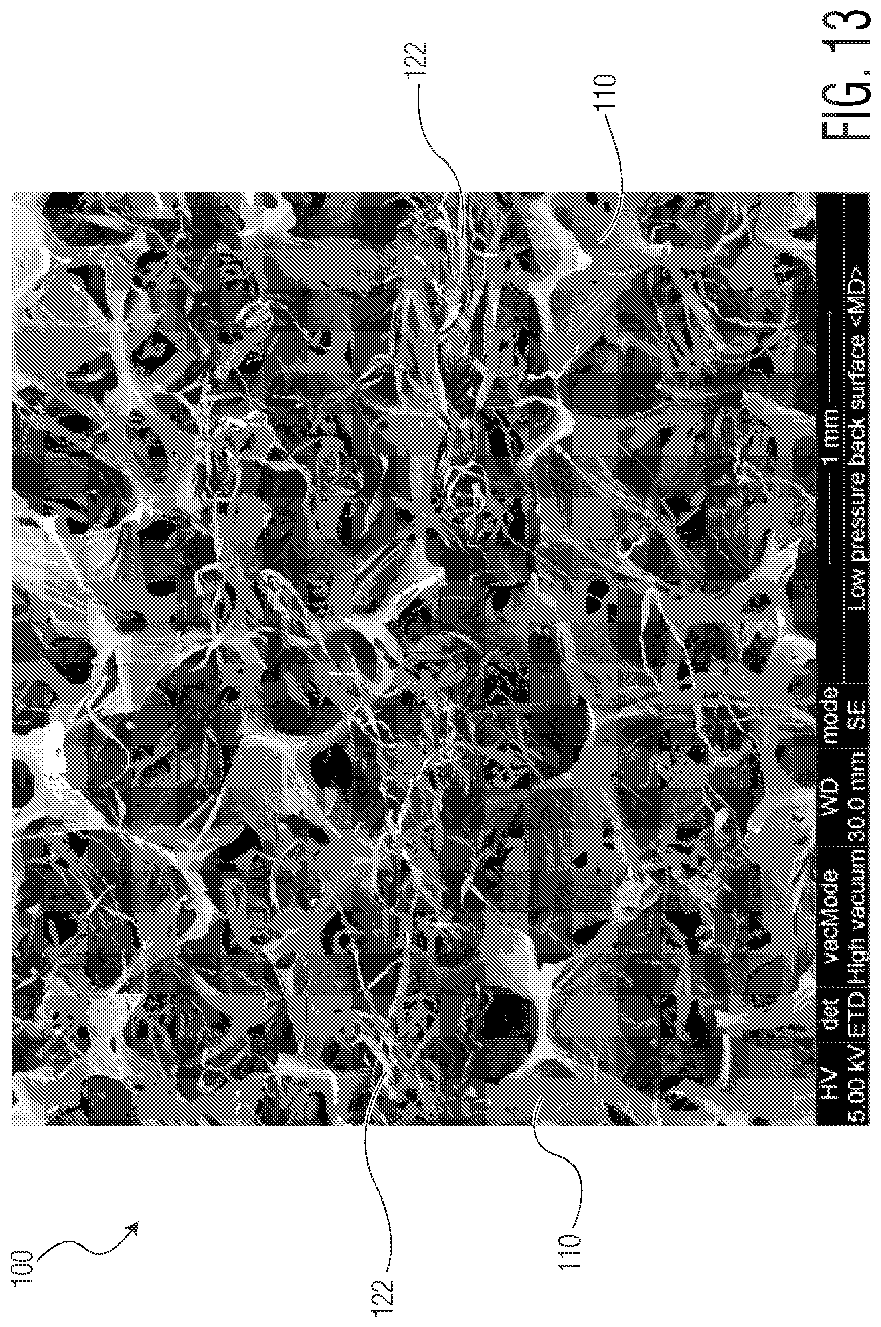 Patent US11771605 Figure 15 – Absorbent article with an exudate management layer