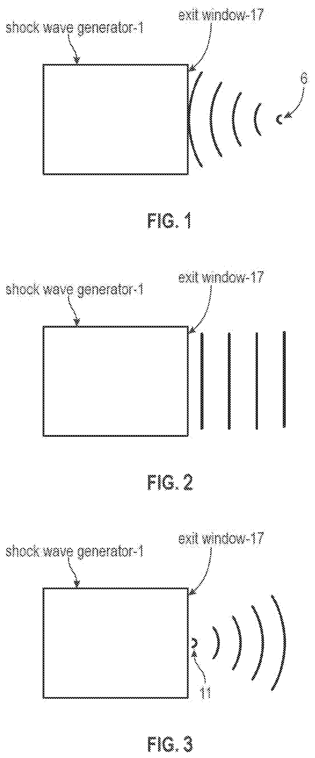 Patent US11771620 Figure 1 – Acoustic shock wave therapeutic methods to prevent or treat opioid addiction