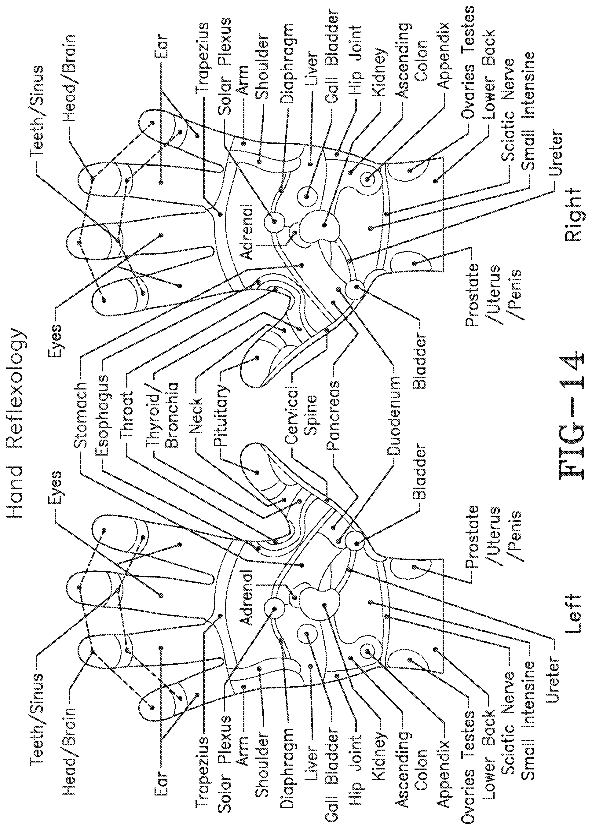 Patent US11771620 Figure 13 – Acoustic shock wave therapeutic methods to prevent or treat opioid addiction