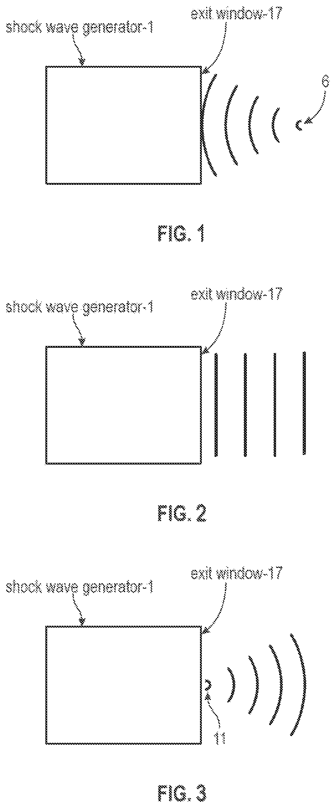 Patent US11771621 — Acoustic shock wave therapeutic methods to prevent or treat opioid addiction — Figure 1