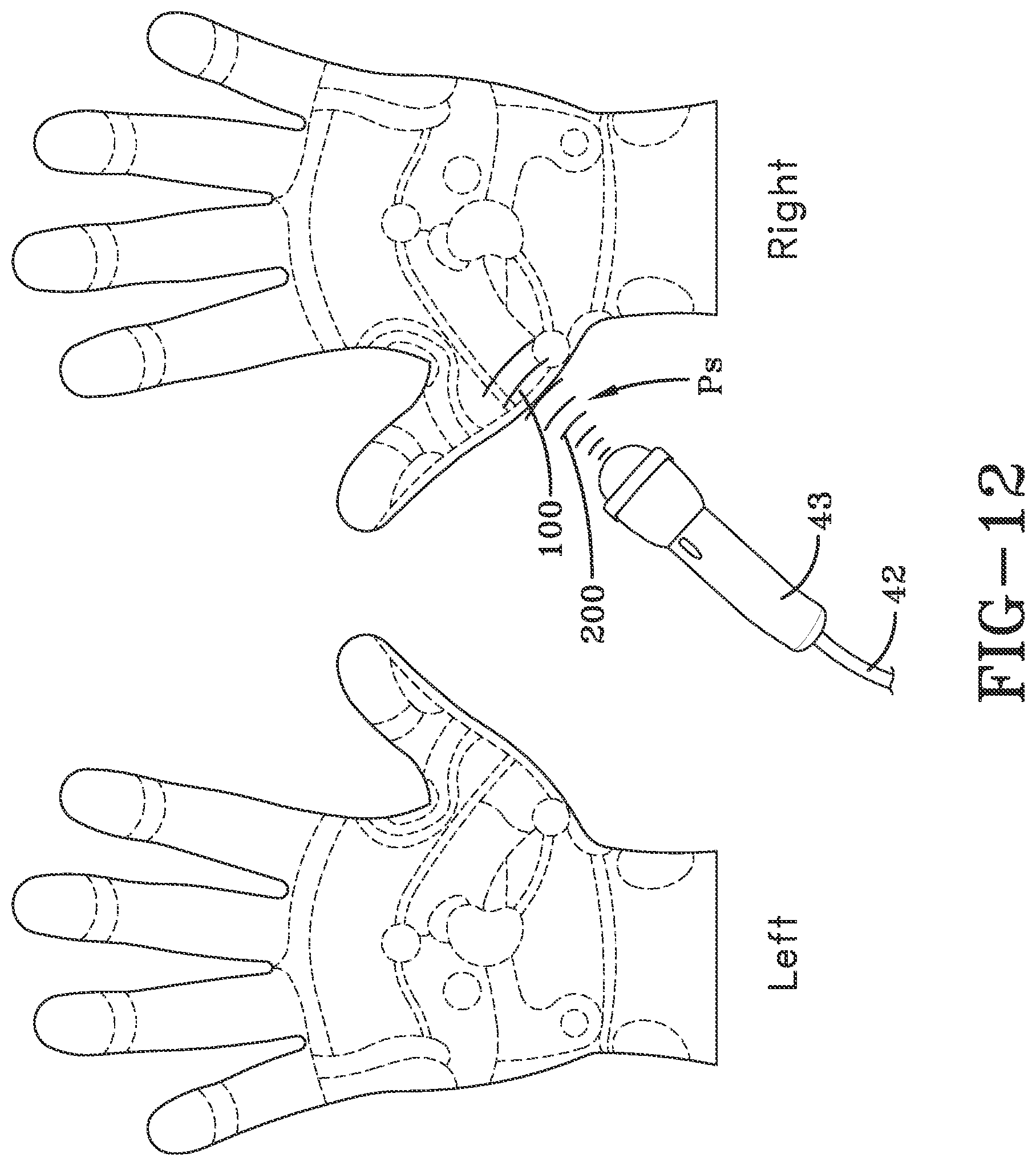 Patent US11771621 Figure 8 – Acoustic shock wave therapeutic methods to prevent or treat opioid addiction