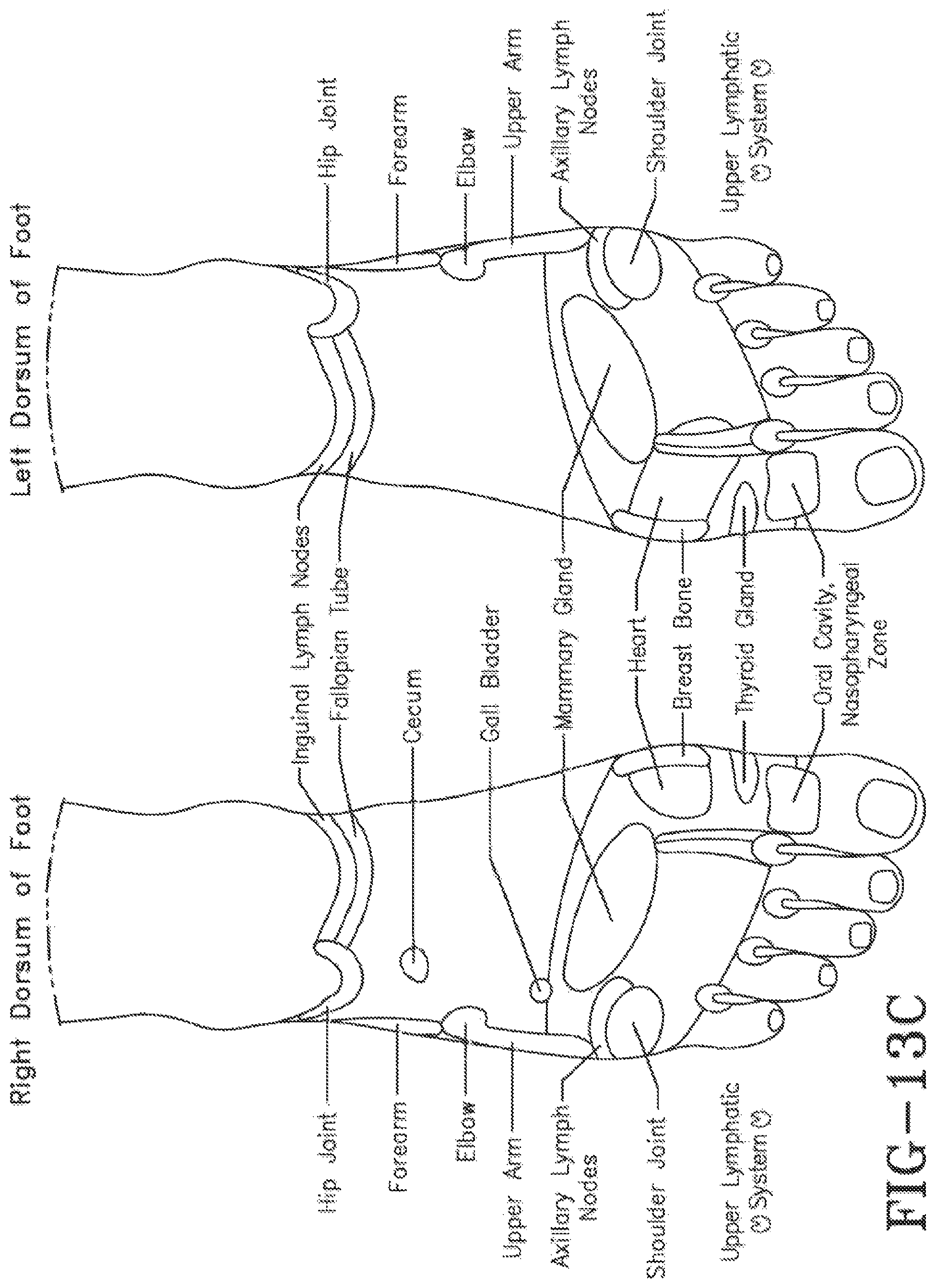 Patent US11771621 Figure 12 – Acoustic shock wave therapeutic methods to prevent or treat opioid addiction