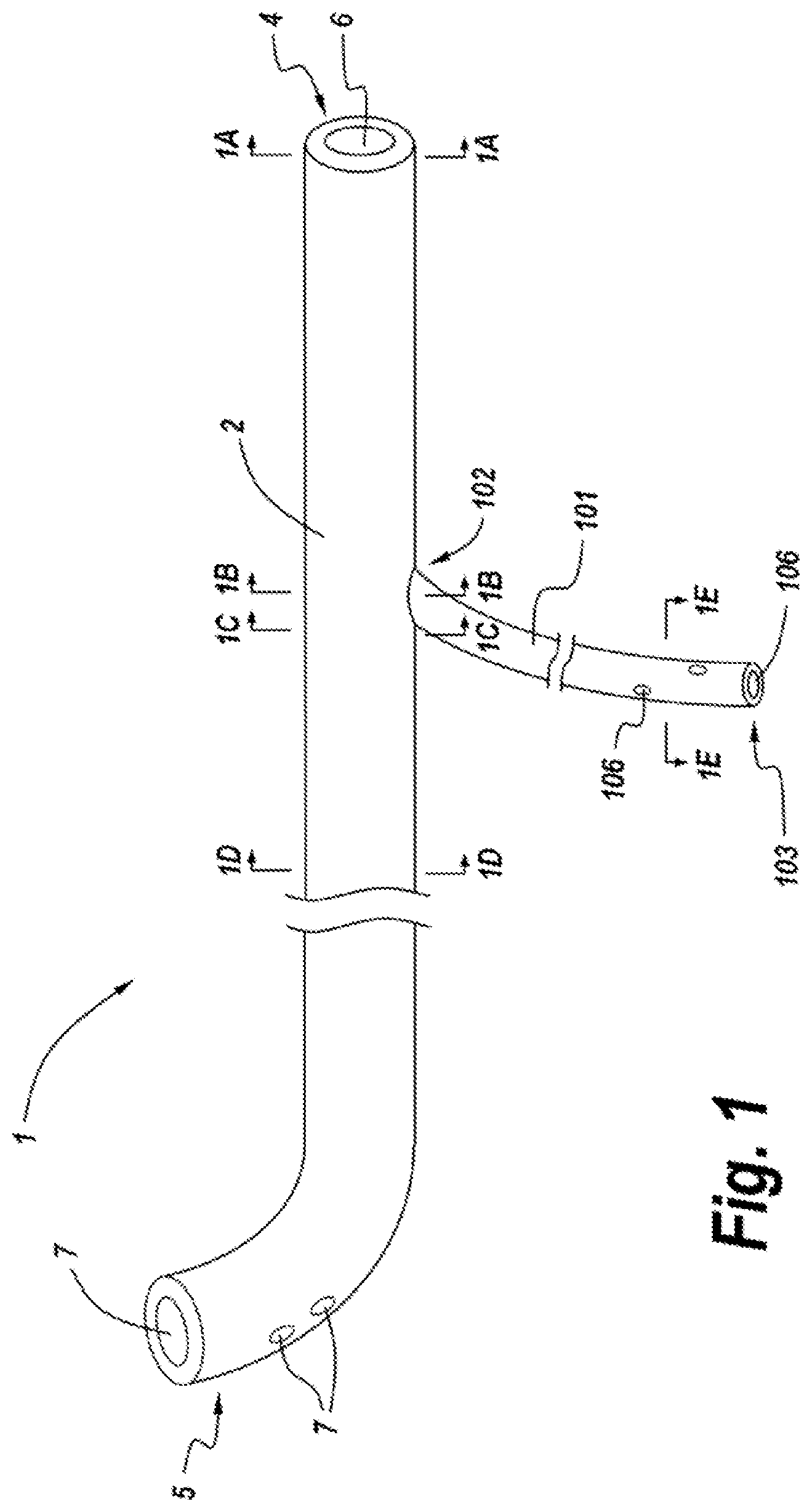 Patent US11771626 — Diverting jejunostomy tube — Figure 1