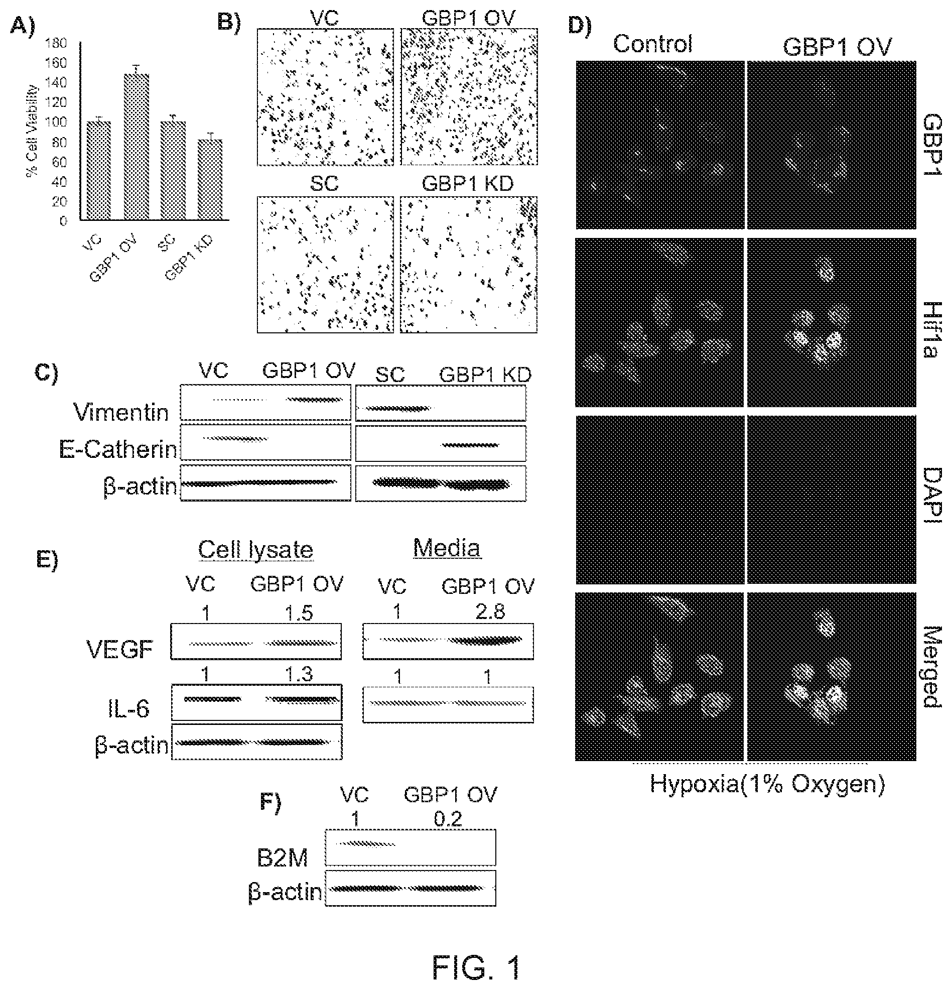 Patent US11771692 — N-hydroxyethyl didehydroazapodophyllotoxins as GBP1 inhibitors and methods of overcoming treatment resistance in cancer — Figure 1