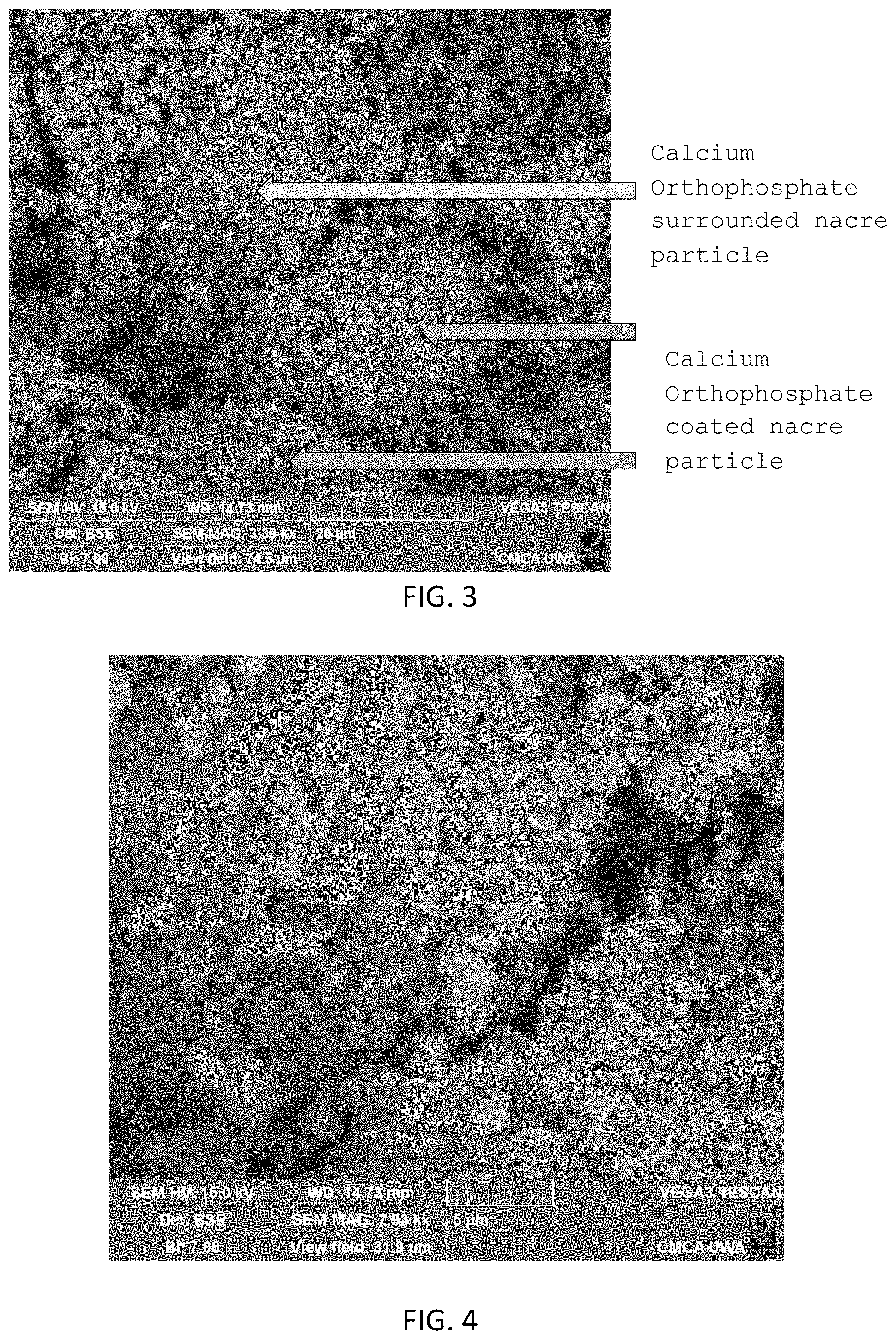 Patent US11771800 Figure 3 – Method for manufacturing a calcified tissue substitute