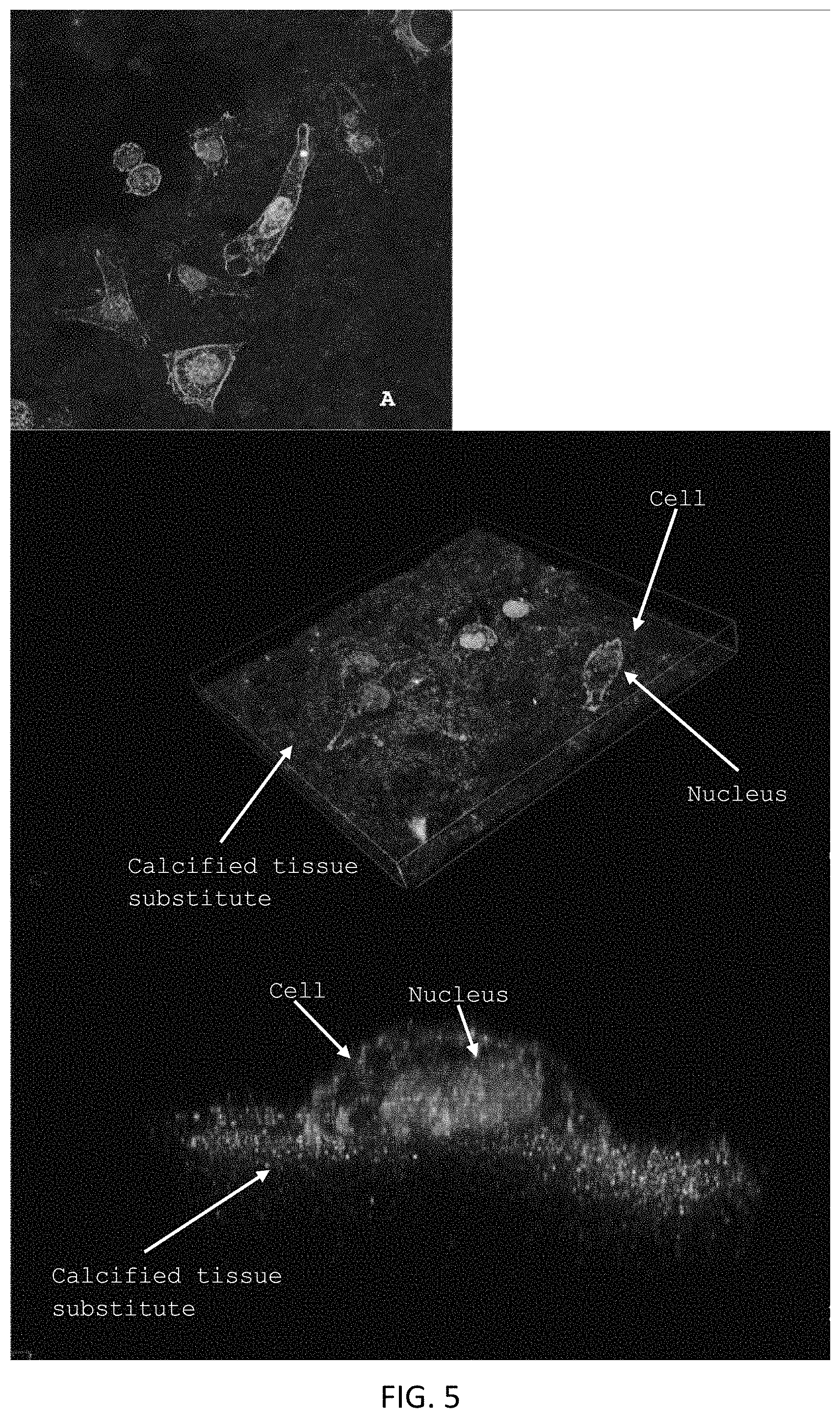 Patent US11771800 Figure 4 – Method for manufacturing a calcified tissue substitute