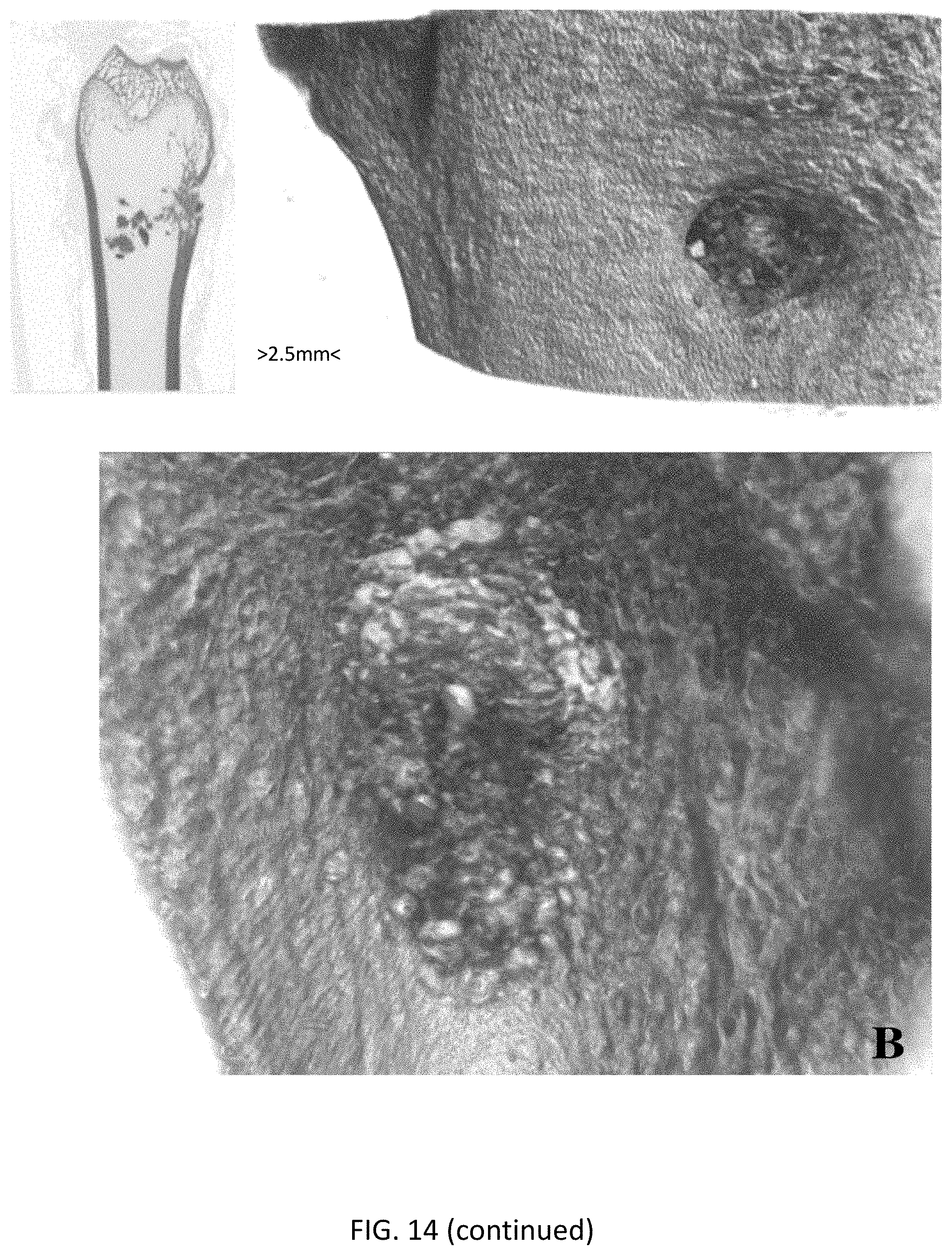 Patent US11771800 Figure 13 – Method for manufacturing a calcified tissue substitute