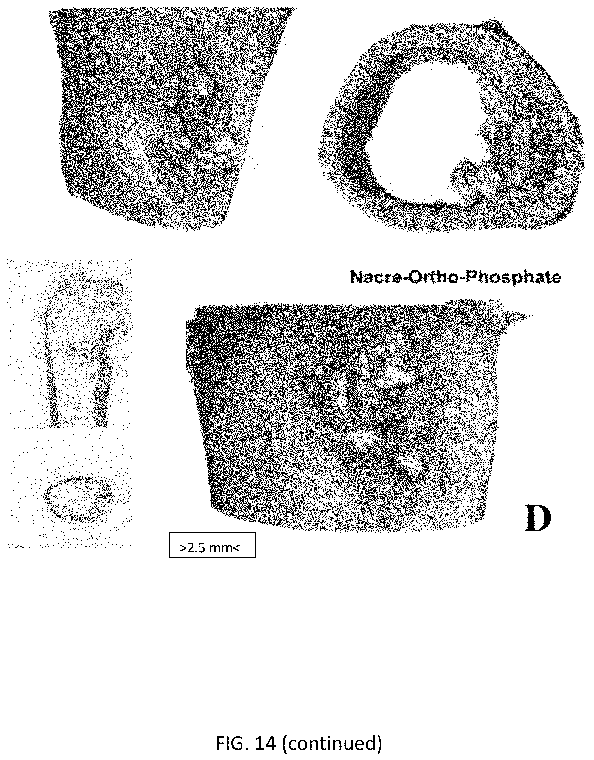 Patent US11771800 Figure 15 – Method for manufacturing a calcified tissue substitute