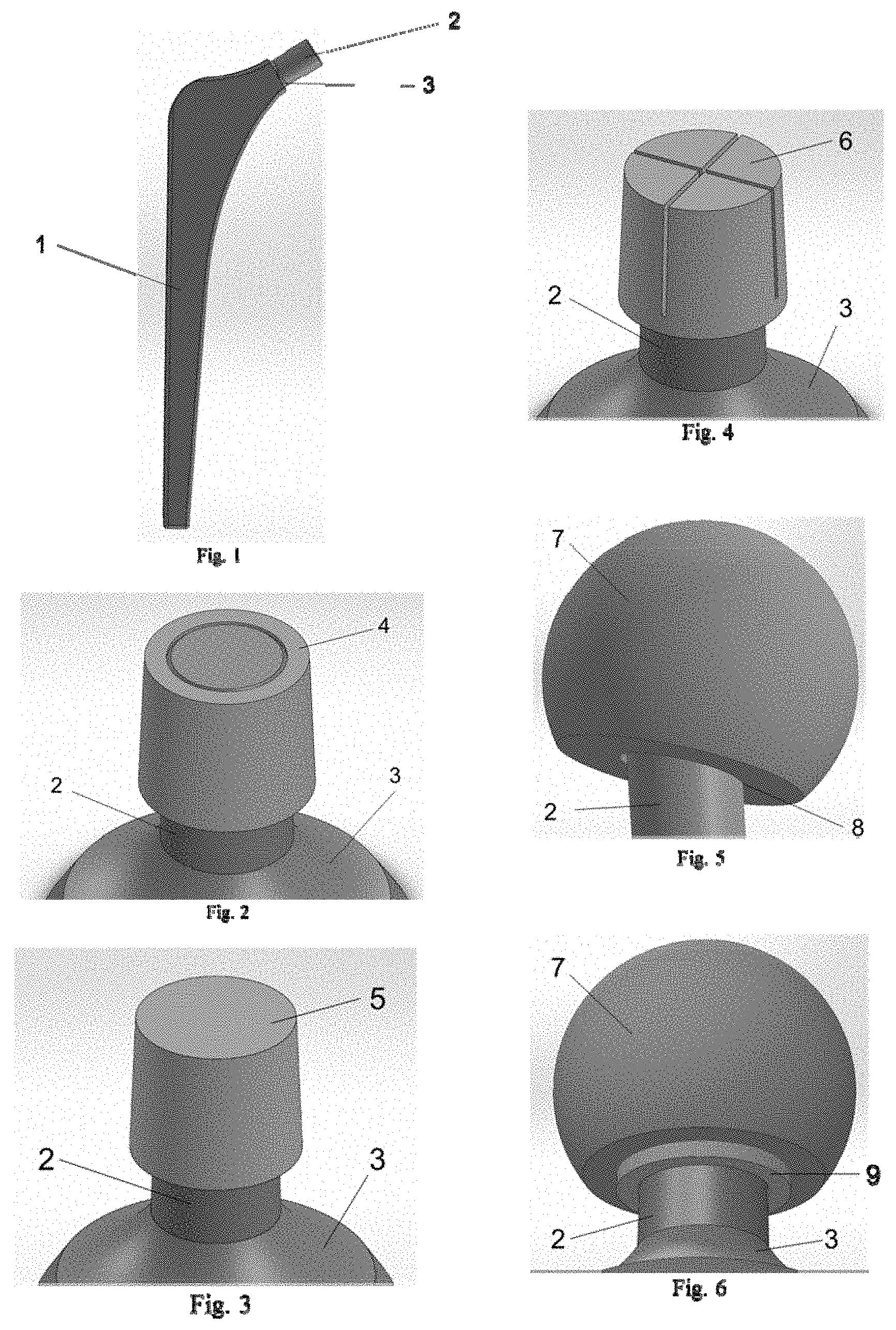 Patent US11771801 — Polymer sleeve for inhibiting stem wear and improving taper-lock in modular and non-modular orthopedic implants and the fabrication and processing thereof — Figure 1