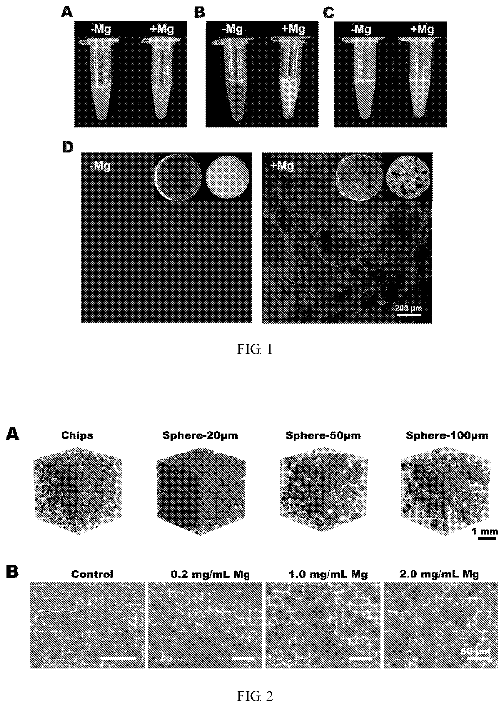 Patent US11771805 — Injectable in situ pore-forming hydrogel system and preparation method and use thereof — Figure 1