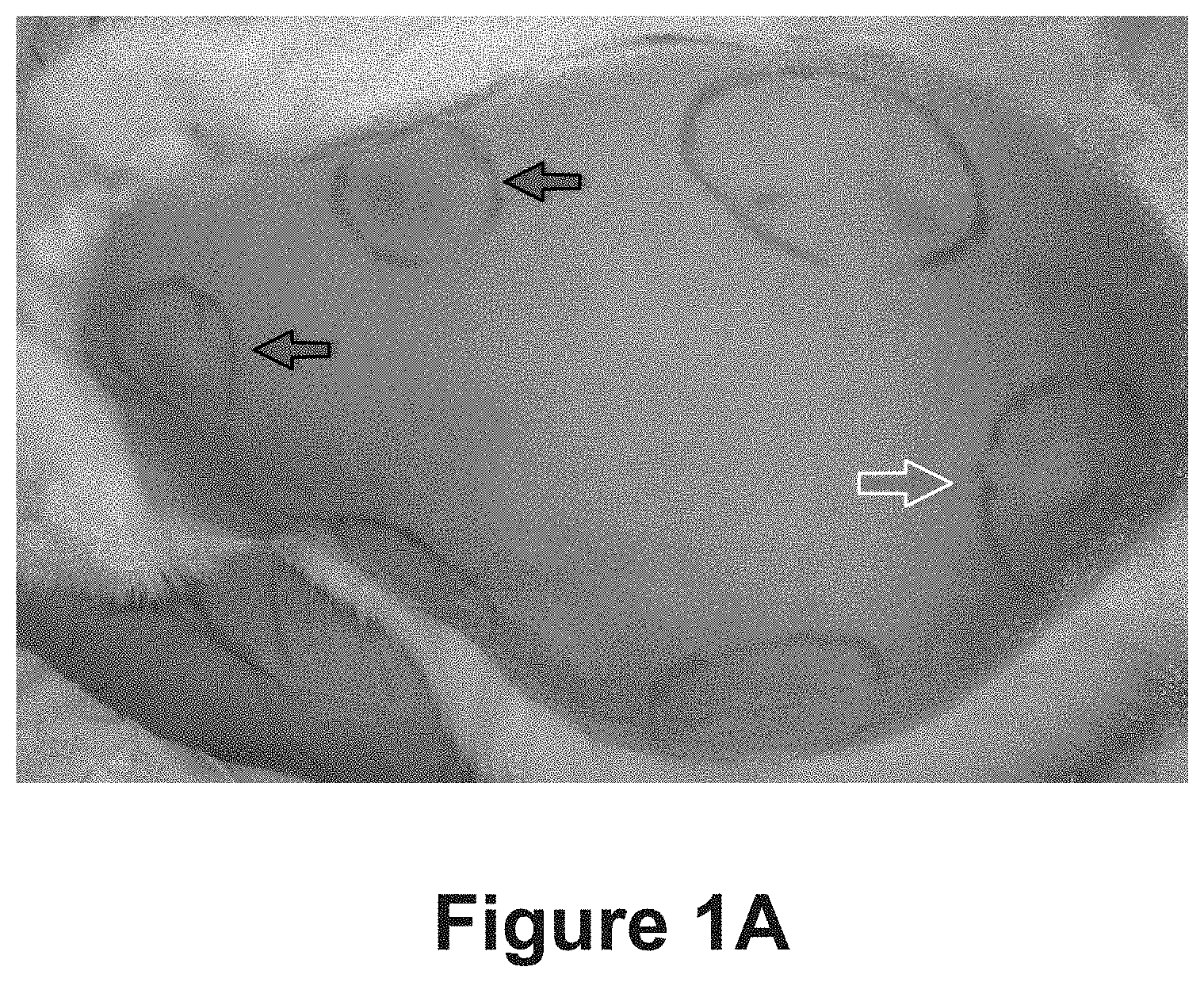Patent US11771807 — Nanofiber-hydrogel composites for cell and tissue delivery — Figure 1