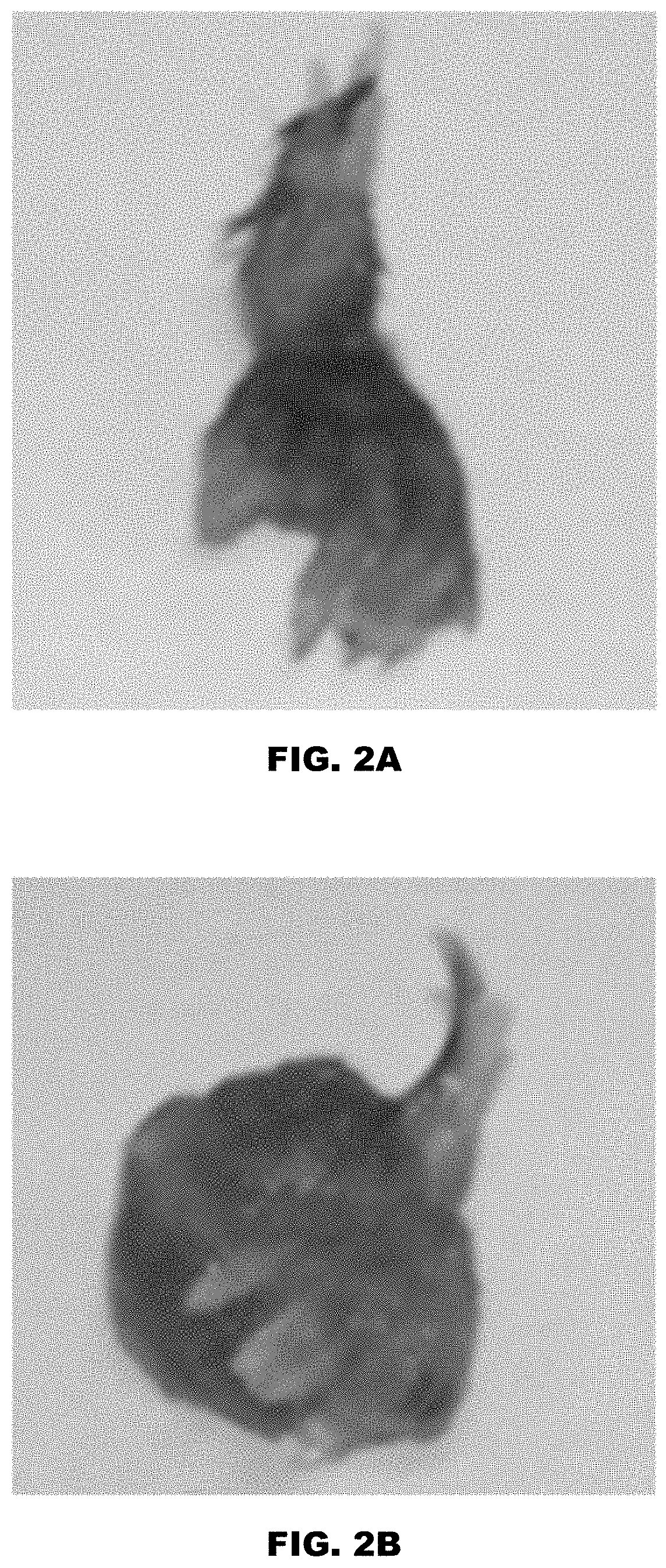 Patent US11771811 Figure 2 – Method and device for purification of blood from circulating cell free DNA
