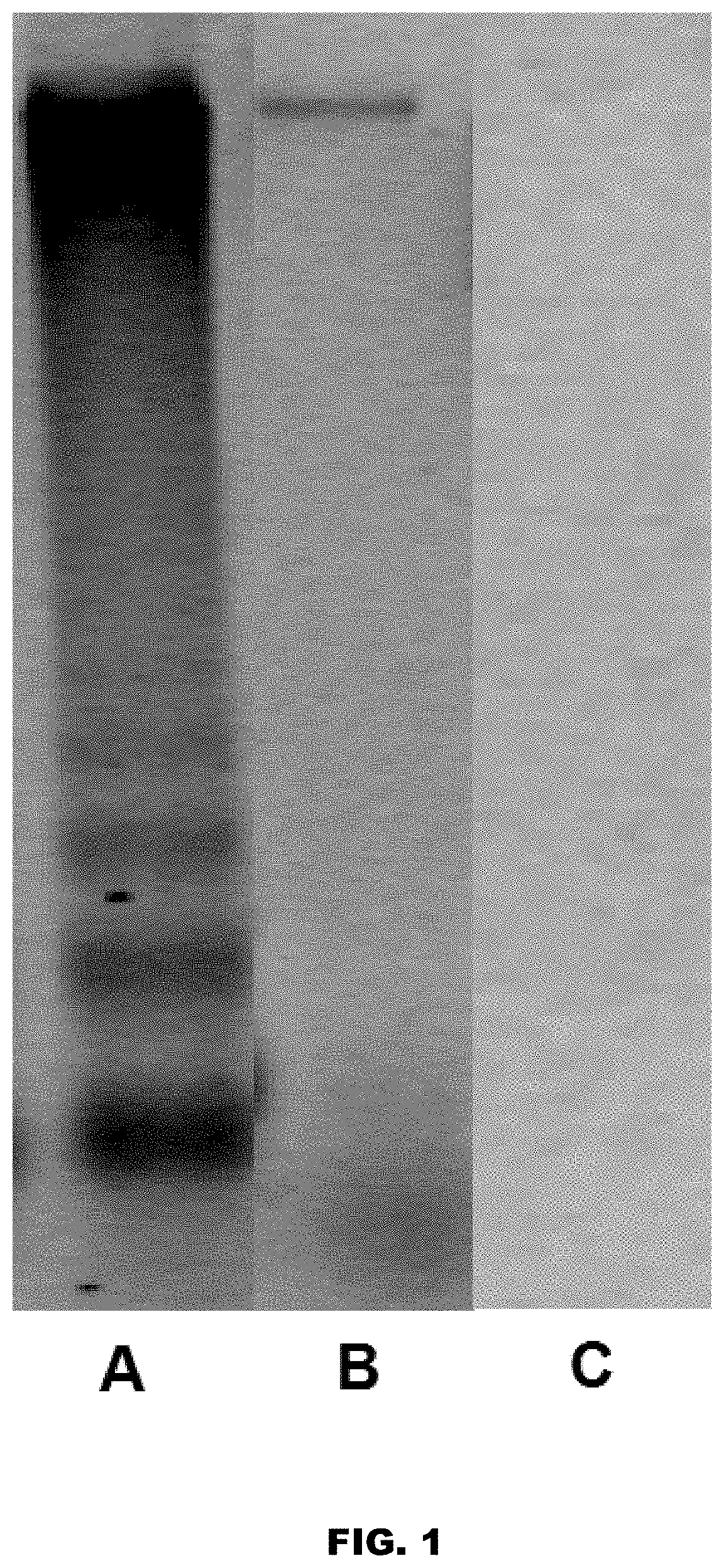 Patent US11771812 Figure 1 – Method and device for purification of blood from circulating cell free DNA
