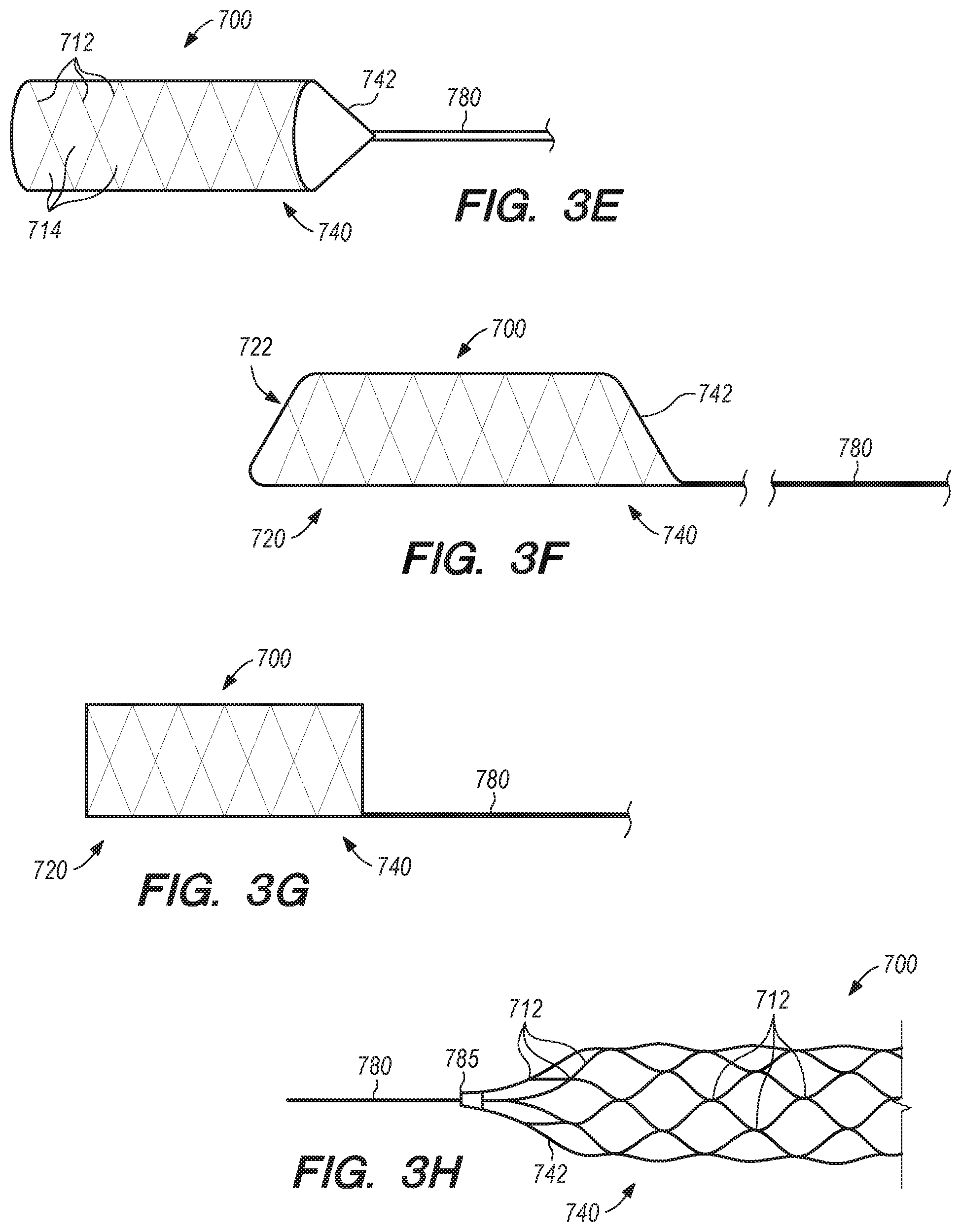 Patent US11771875 Figure 4 – Catheter systems and methods for medical procedures using catheters