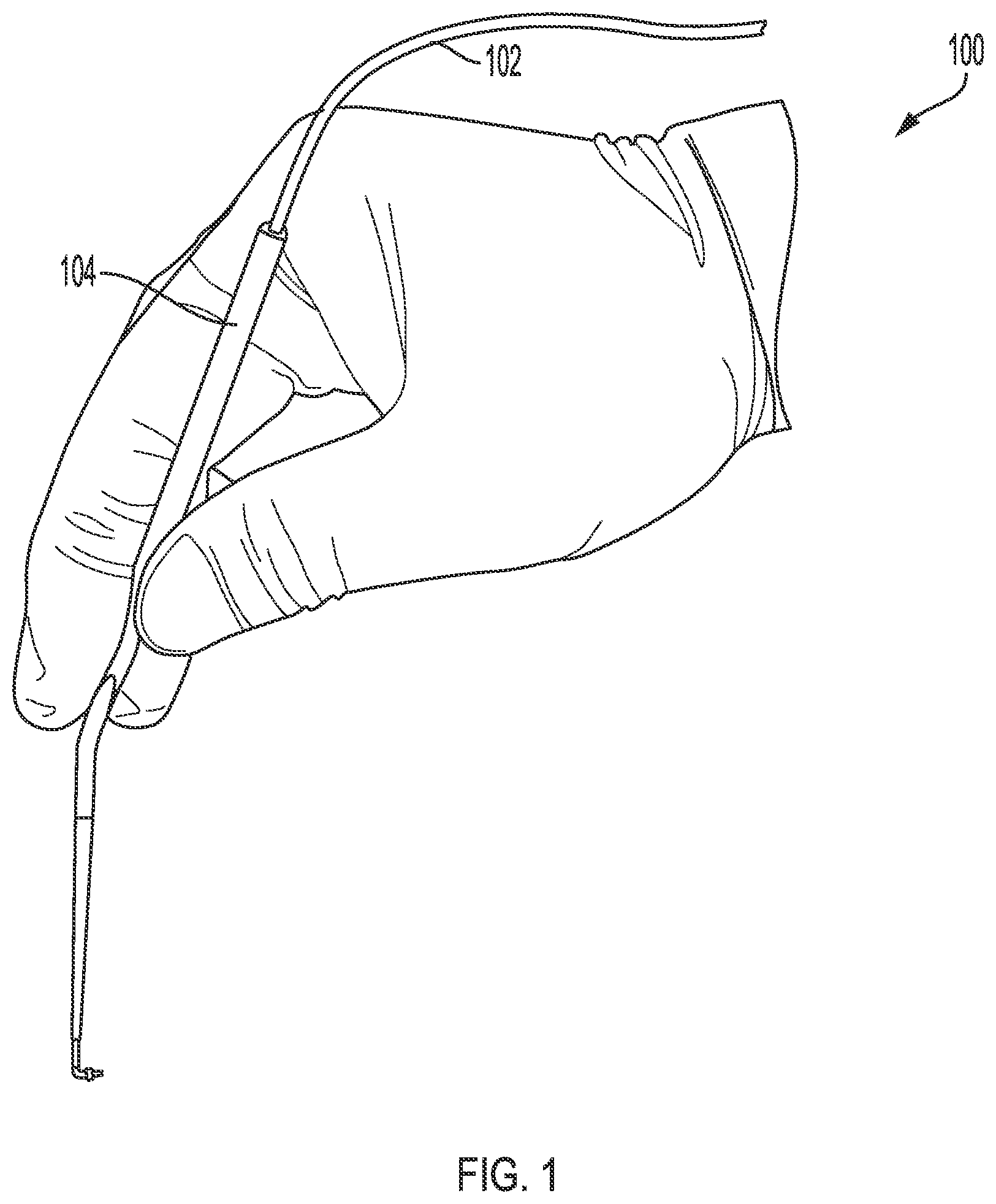 Patent US11771876 — System for inner ear drug delivery via trans-round window membrane injection — Figure 1