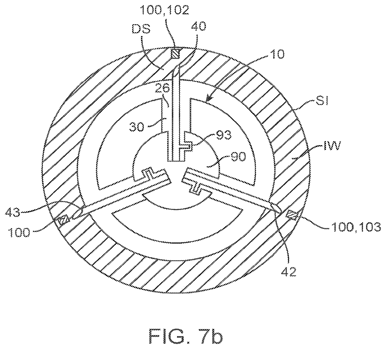 Patent US11771879 Figure 11 – Therapeutic agent preparations for delivery into a lumen of the intestinal tract using a swallowable drug delivery device