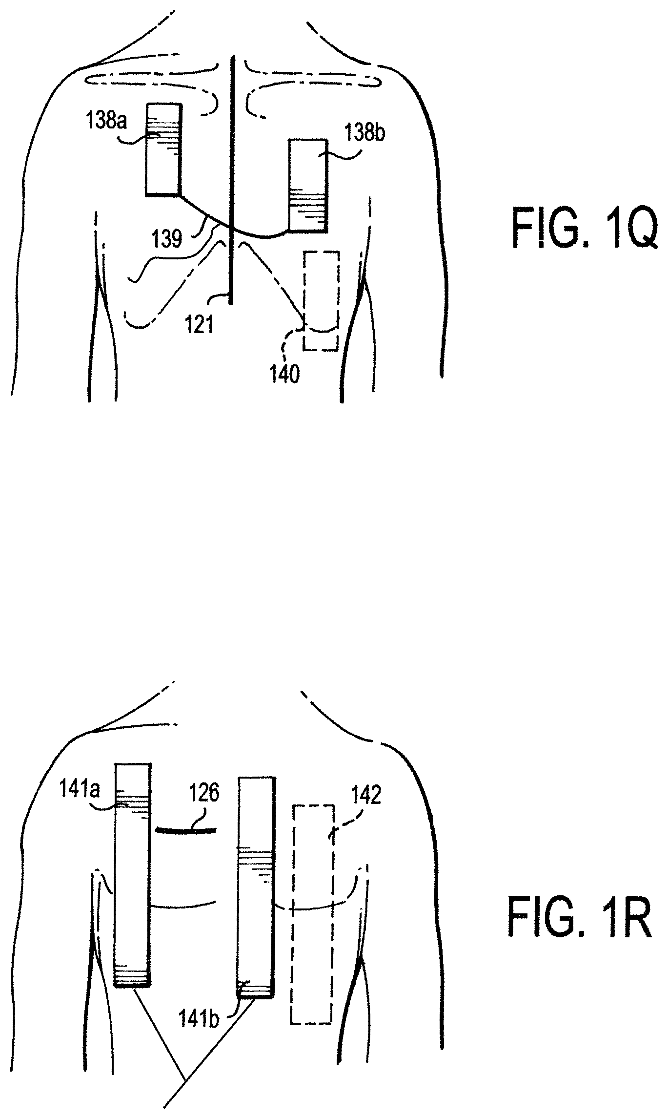 Patent US11771887 Figure 7 – Configurable electrodes and sensors