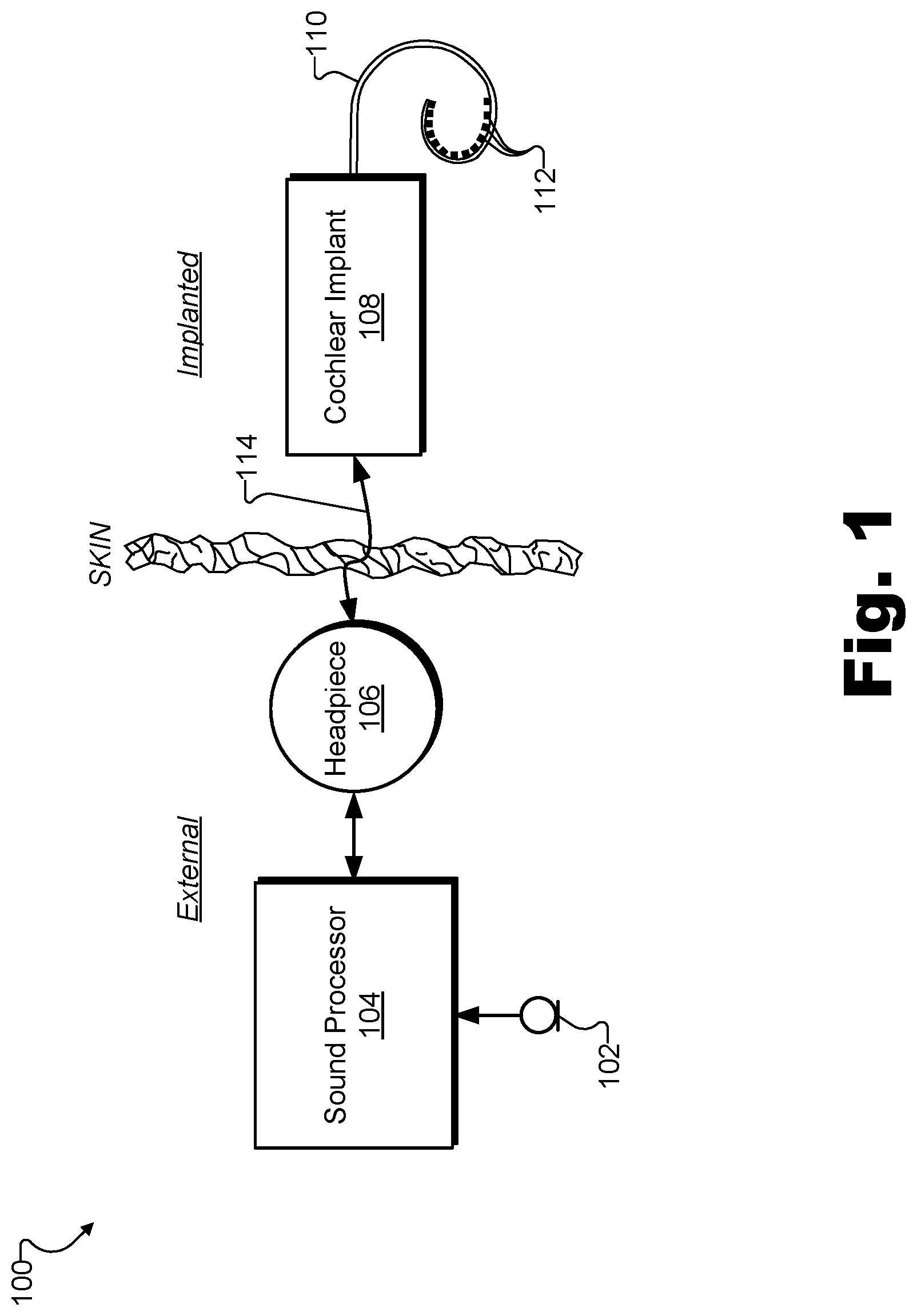 Patent US11771903 — Apparatuses and methods for managing stimulation parameters for an implant — Figure 1