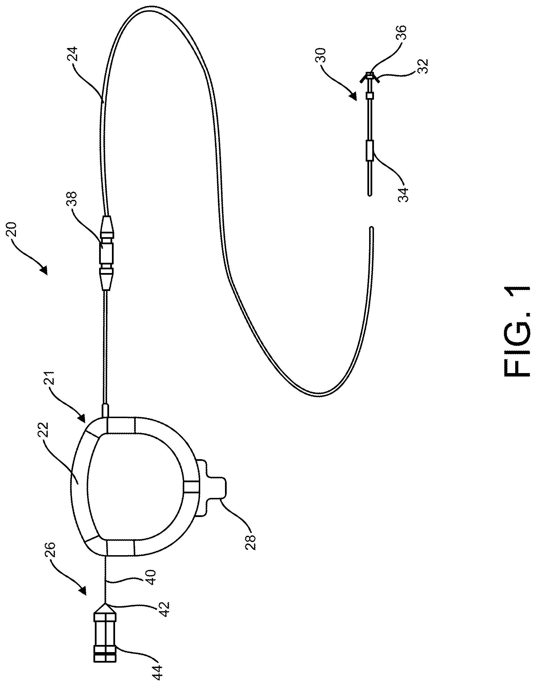 Patent US11771906 — Temporary pacemaker — Figure 1