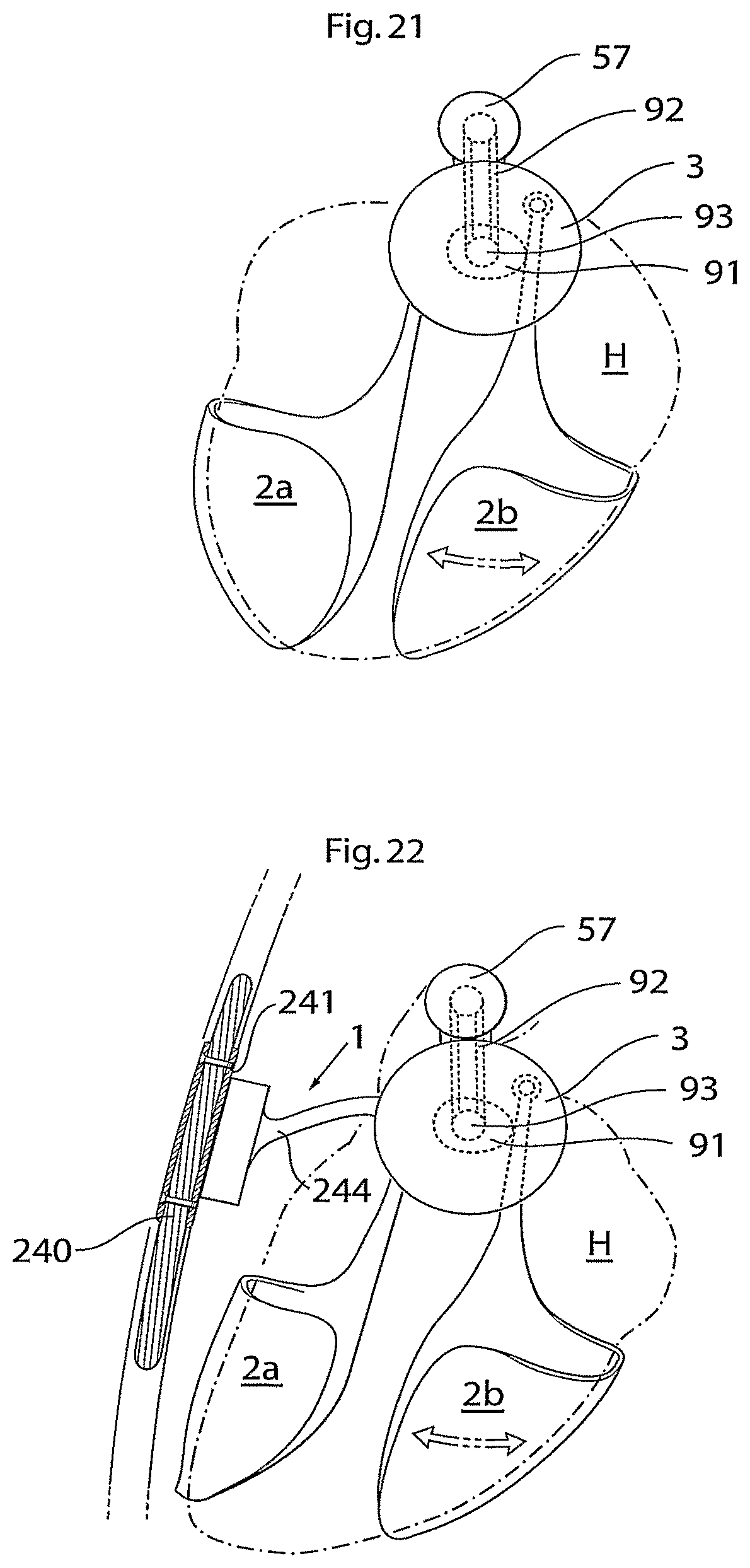 Patent US11771907 Figure 9 – Heart help device, system, and method