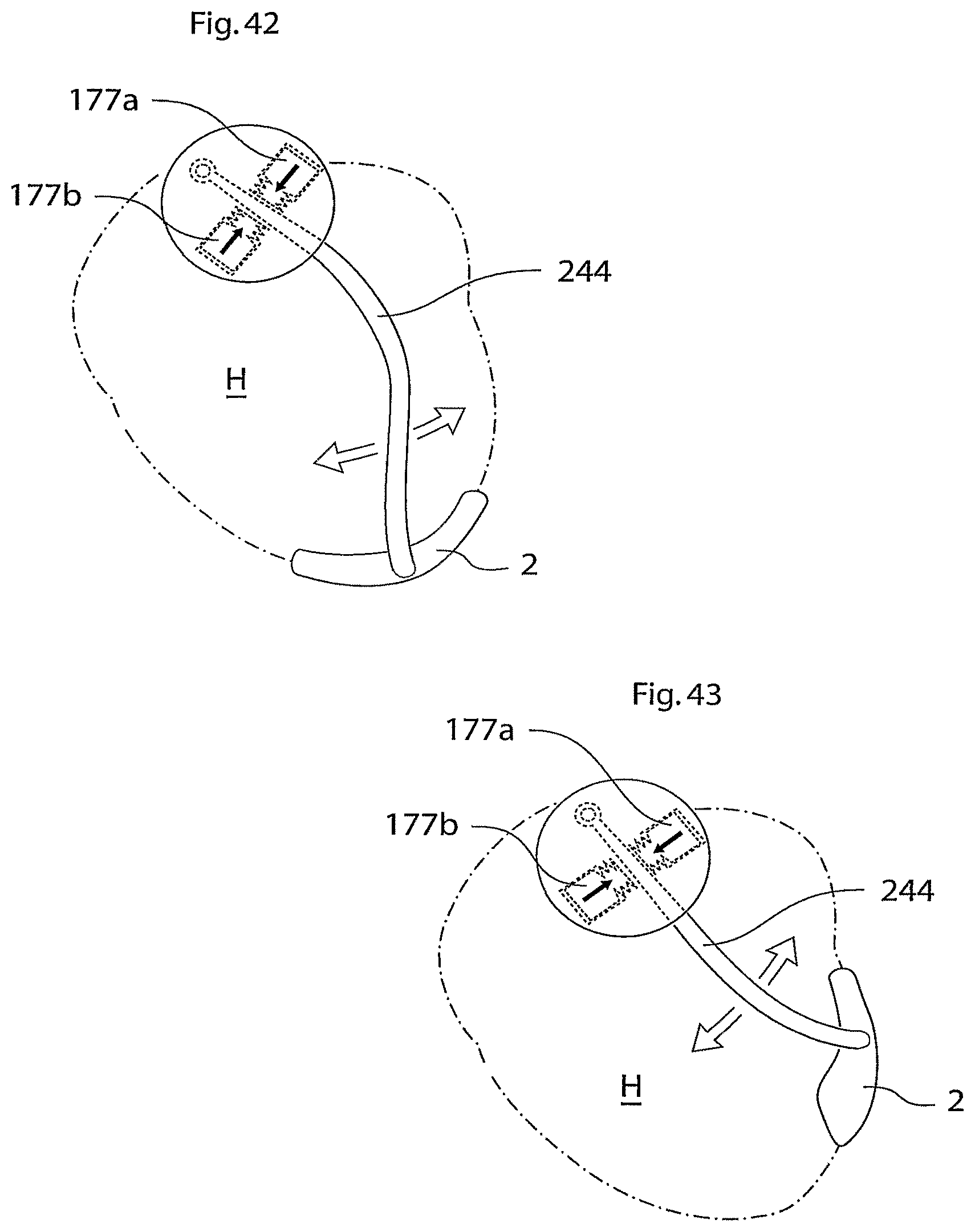 Patent US11771907 Figure 17 – Heart help device, system, and method