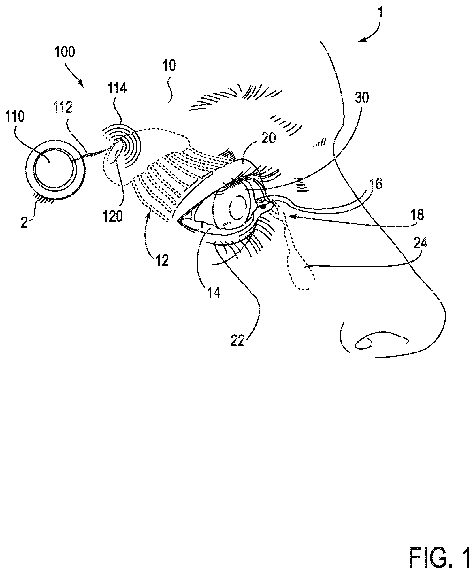 Patent US11771908 — Systems and methods for treatment of dry eye — Figure 1