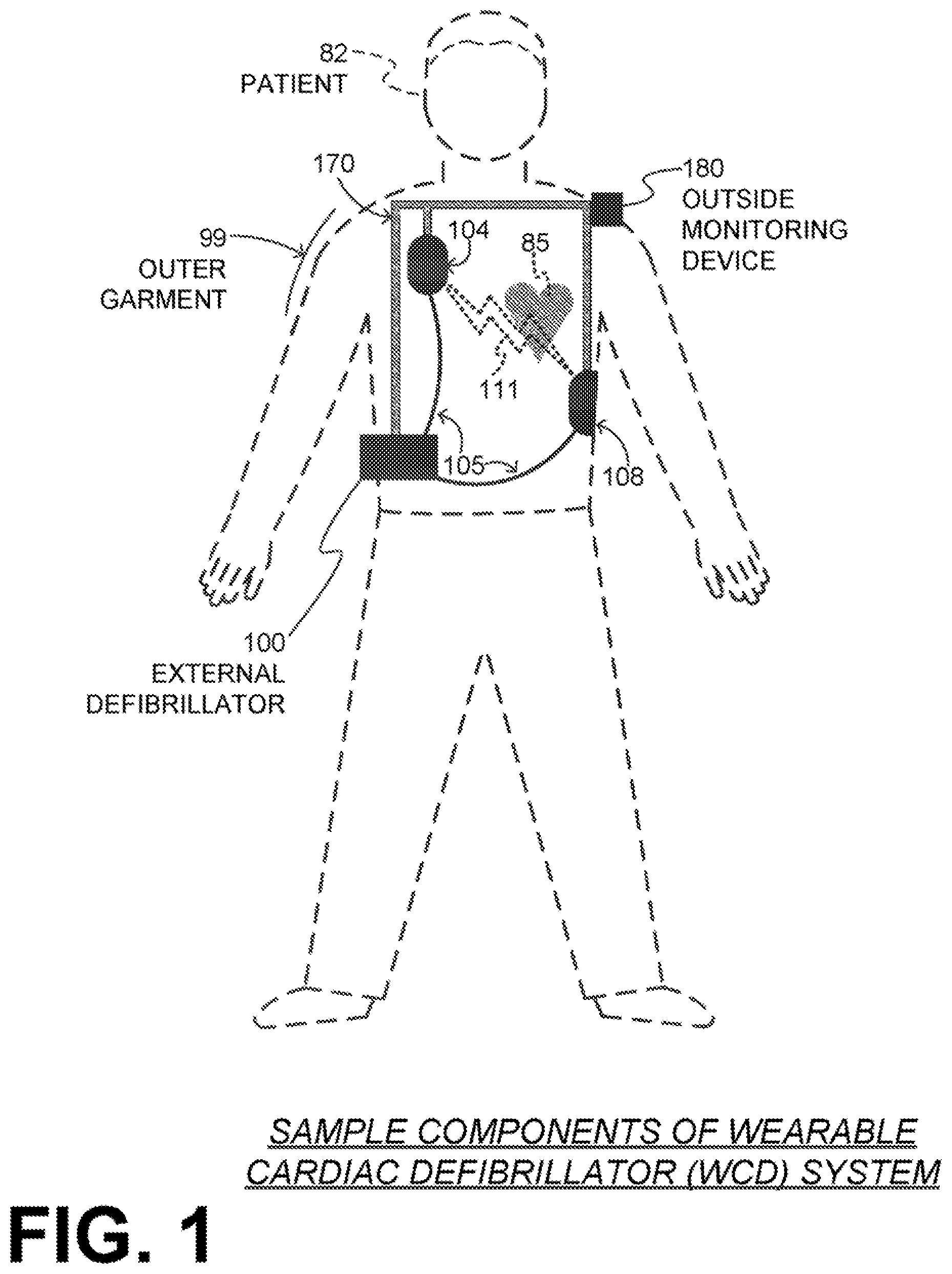 Patent US11771909 — Wearable cardiac defibrillator system authenticating person actuating cancel switch — Figure 1