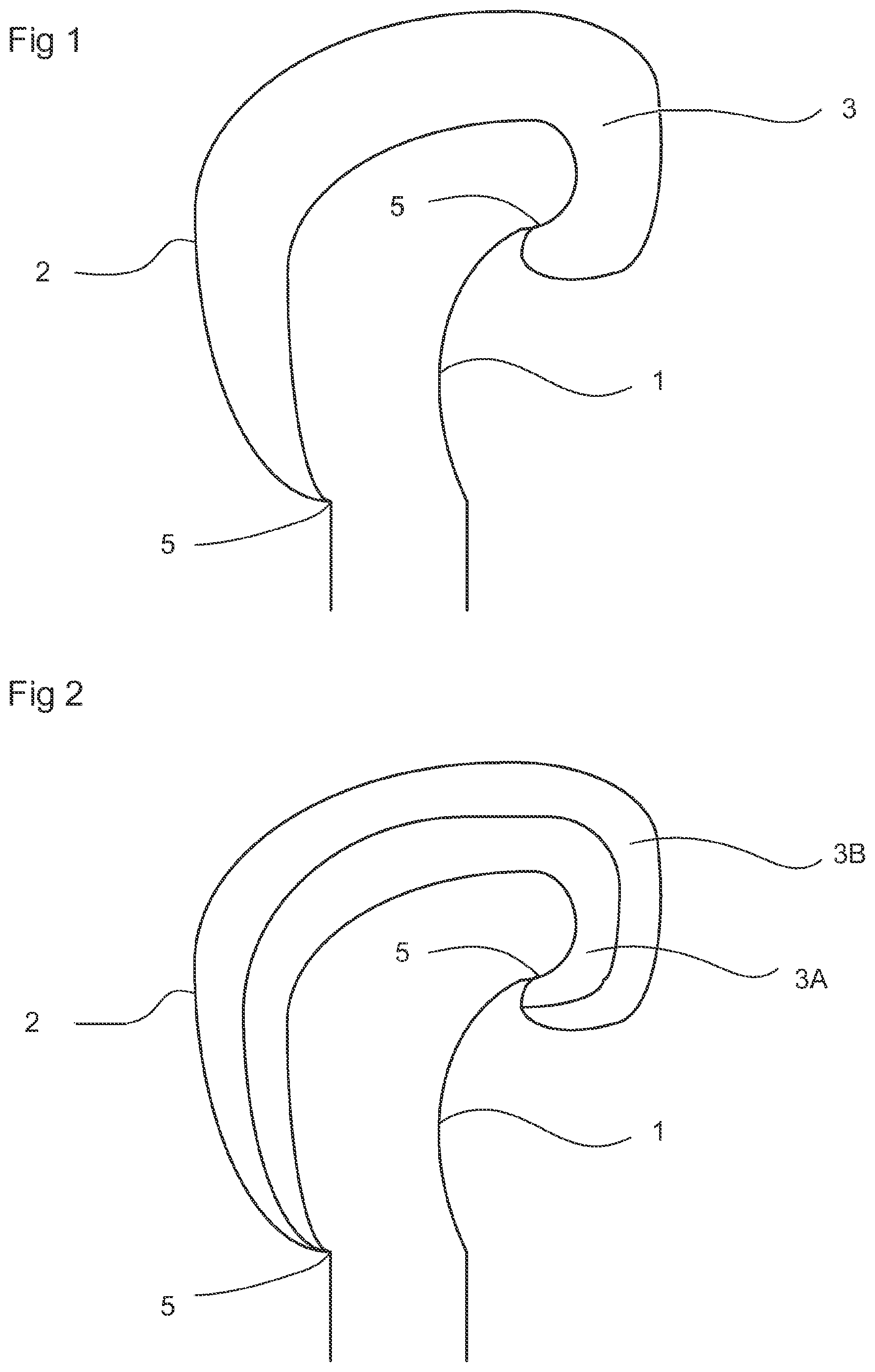 Patent US11771979 — Glove — Figure 1