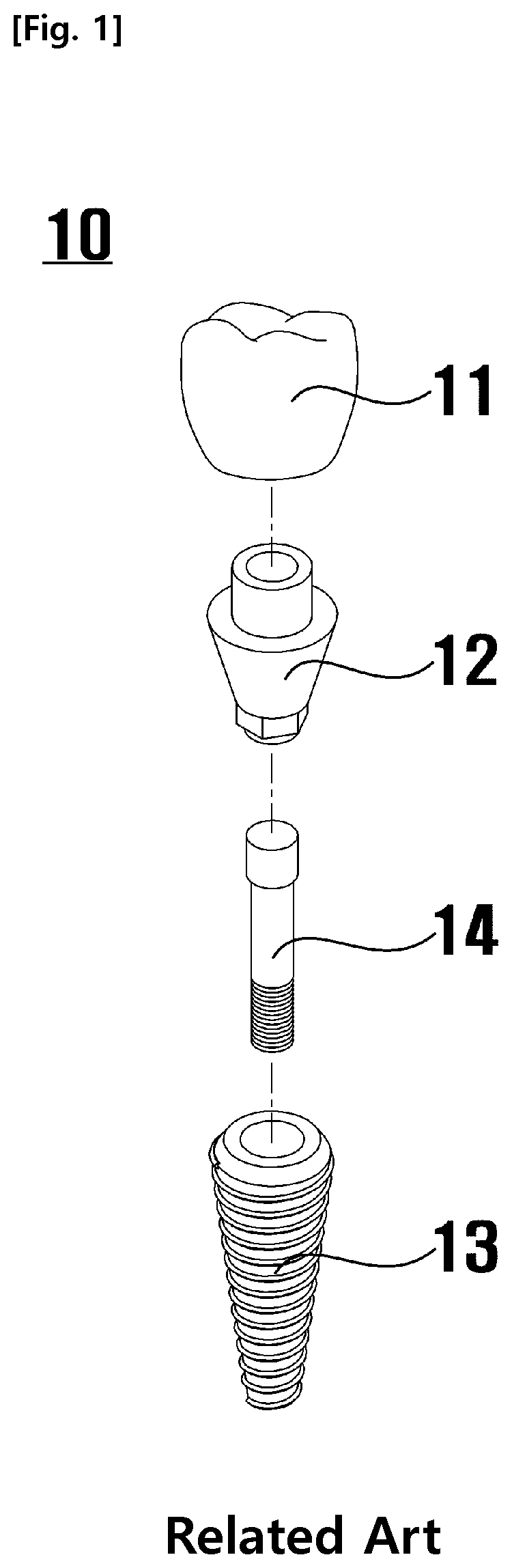 Patent US11772133 — Method for removing residual acid of implant — Figure 1