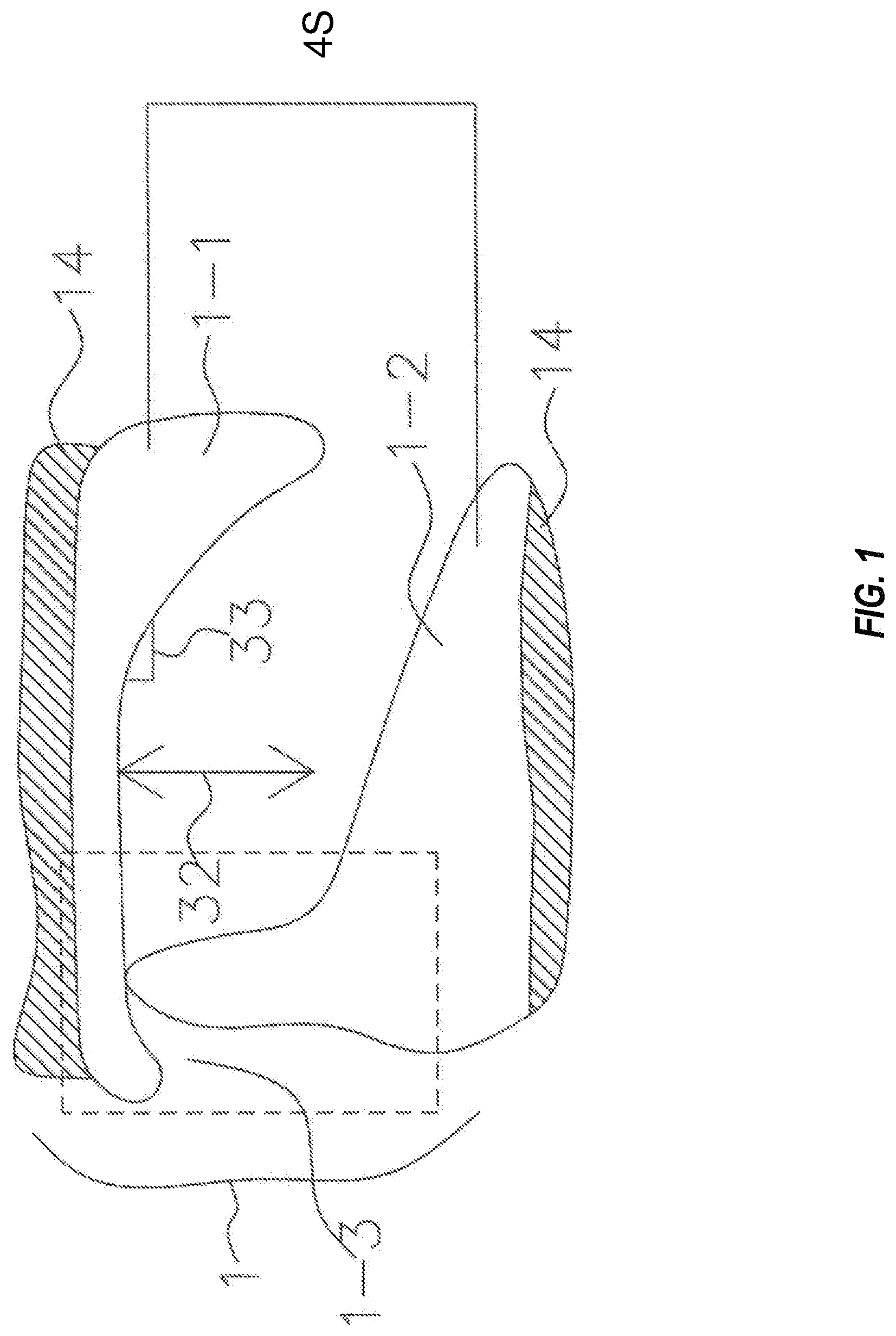 Patent US11772331 Figure 1 – System and method for producing dental solutions incorporating a guidance package