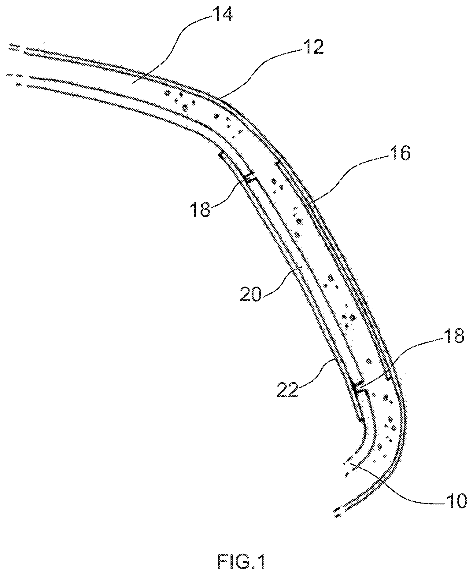 Patent US11772576 — Interior trim part for a motor vehicle and method of its manufacture — Figure 1
