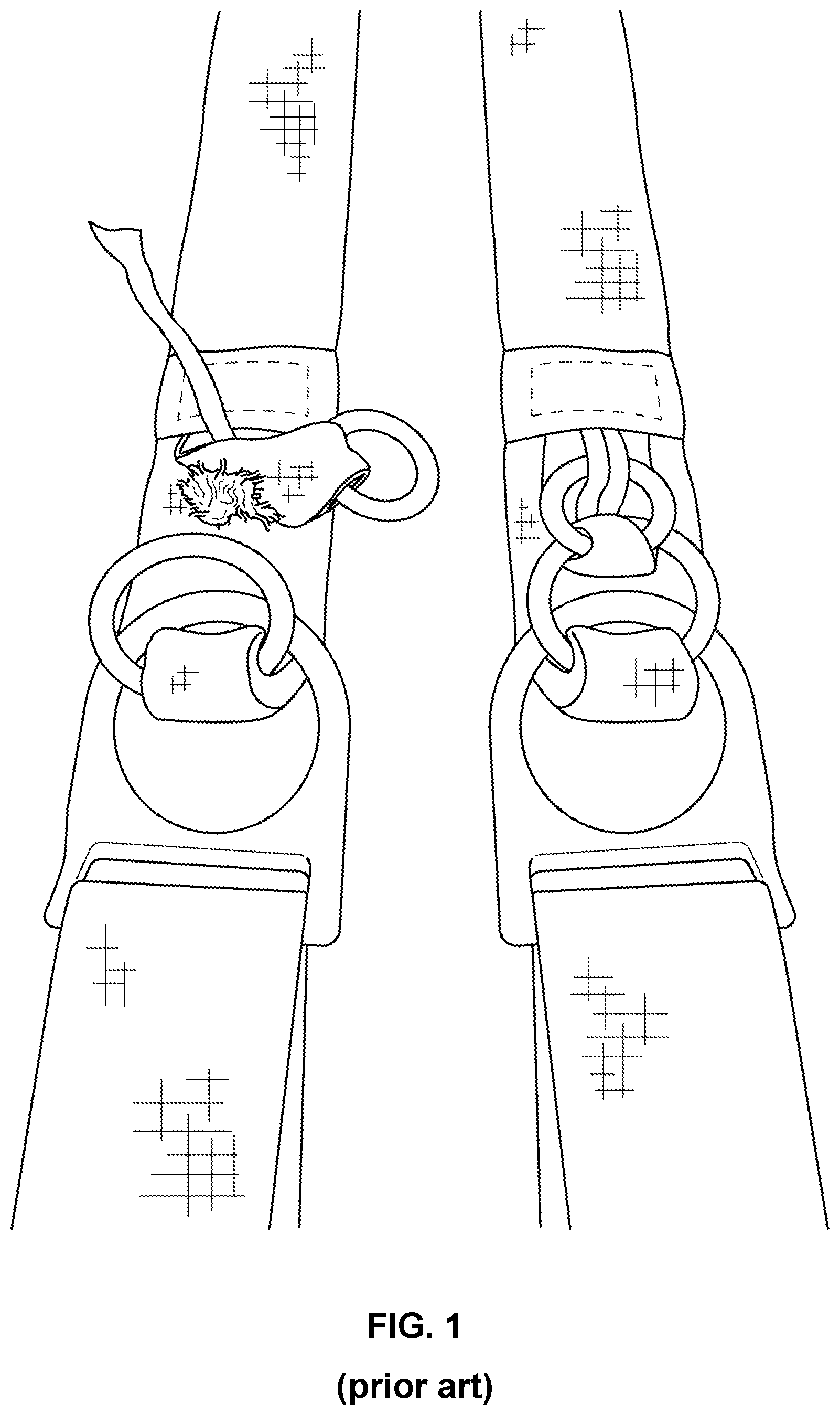 Patent US11772802 — Ring release systems and methods utilizing a removable pin — Figure 1