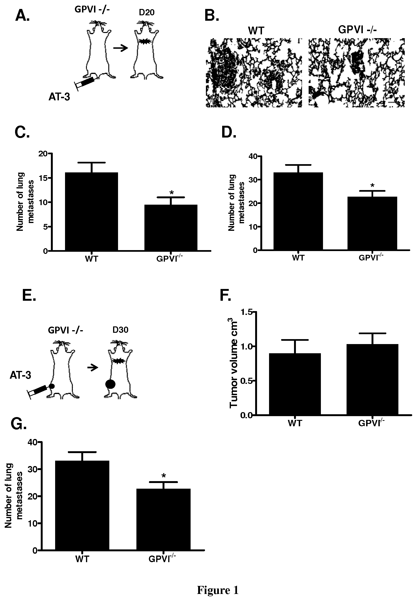 Patent US11773163 — Methods and pharmaceutical compositions for the prophylactic treatment of metastases — Figure 1