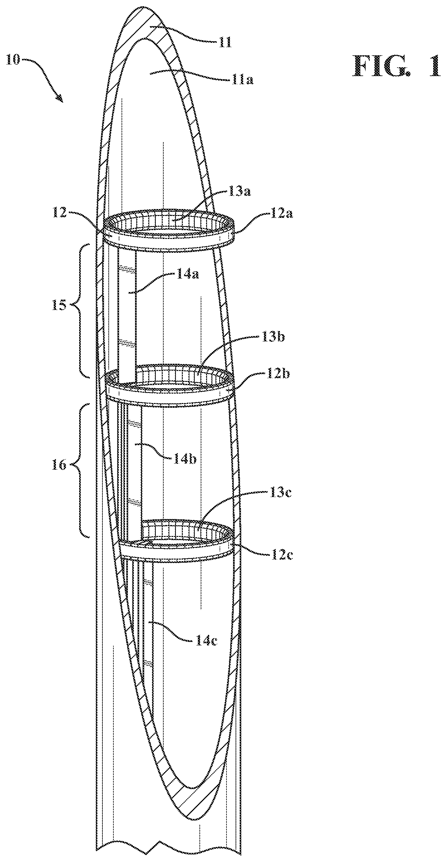 Patent US11773495 Figure 1 – Vitreous coating application by induction heating and integration with induction kinetic weld joining