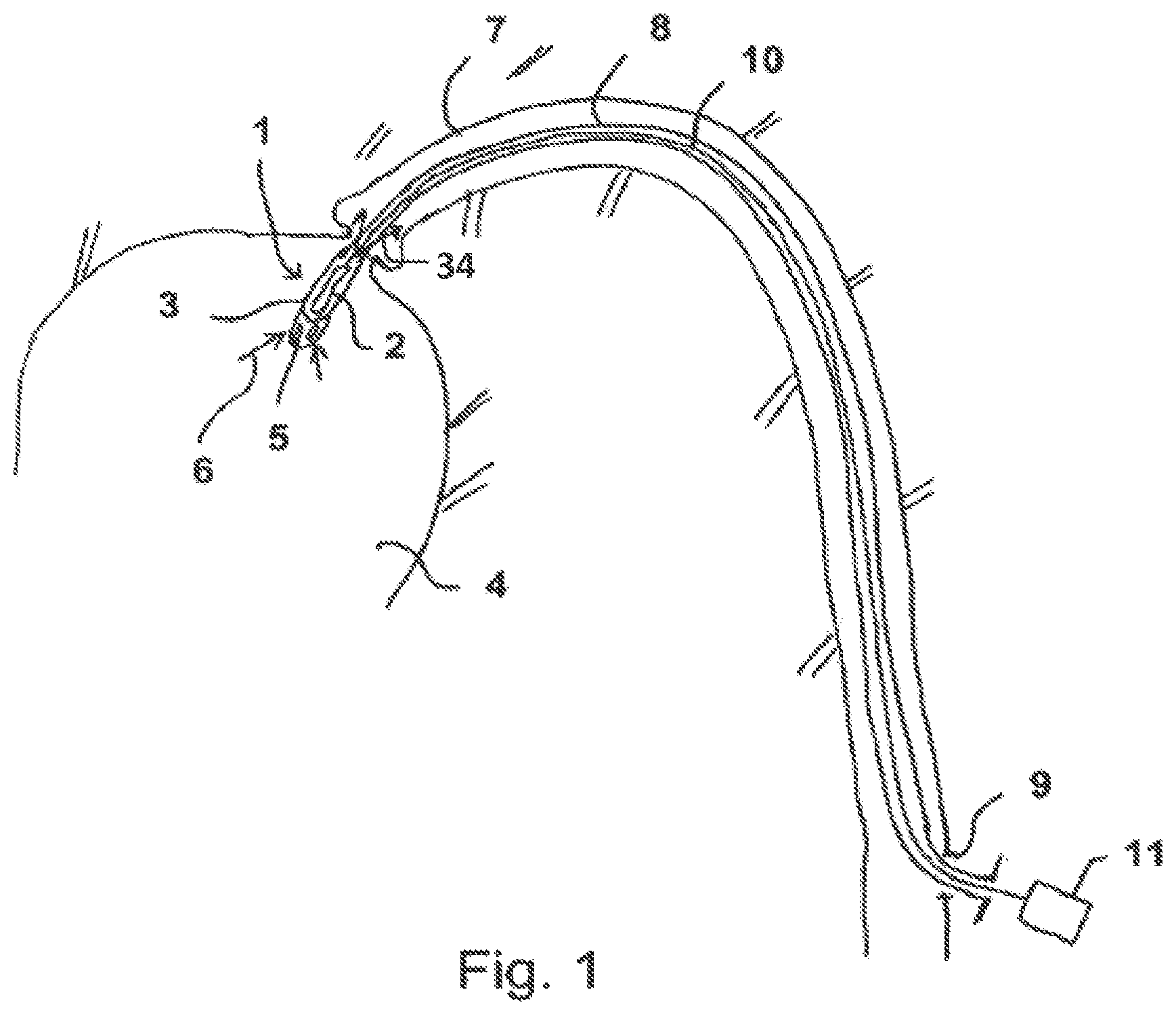 Patent US11773861 Figure 1 – Compressible rotor for a fluid pump