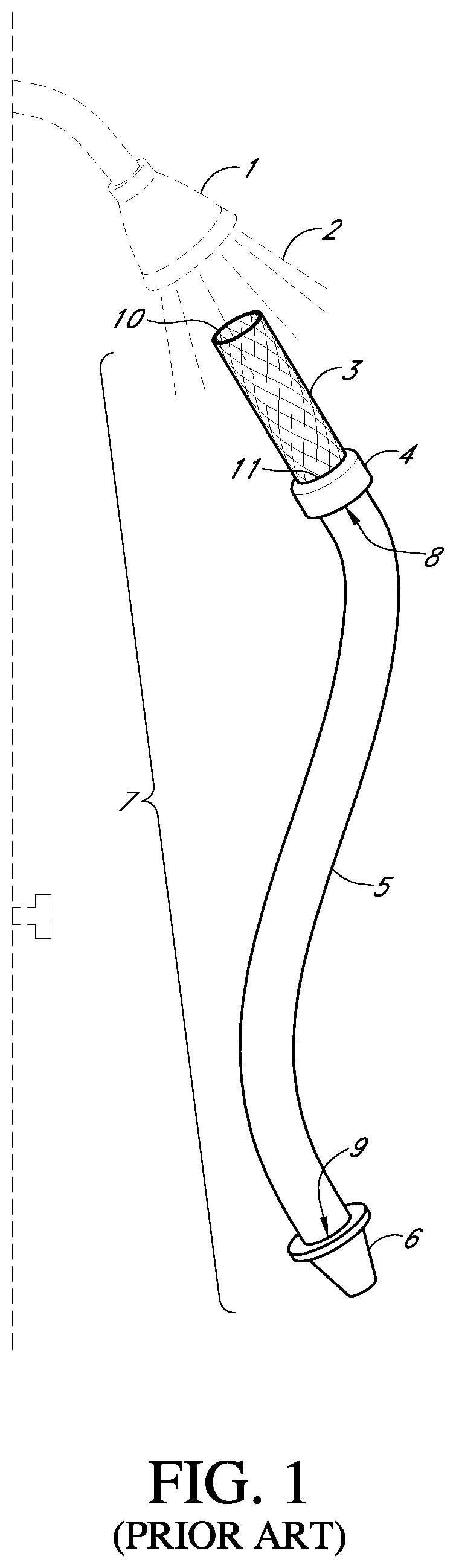Patent US11774021 — Connector assembly and methods of use — Figure 1