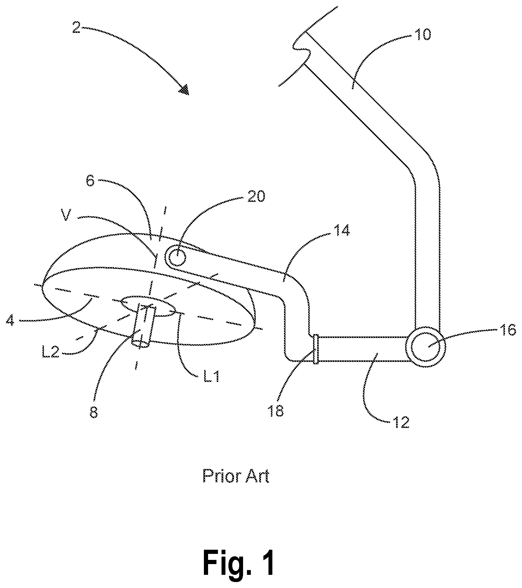Patent US11774076 Figure 1 – Aerodynamic surgical light and boom systems